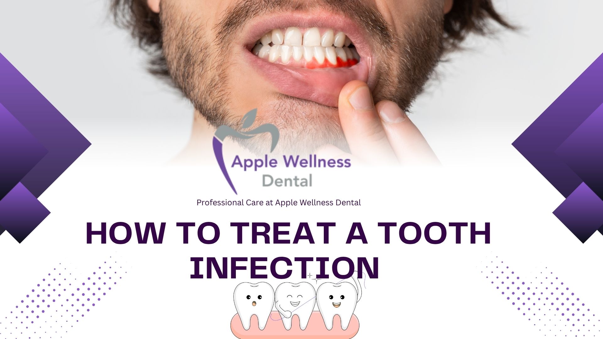 How to Treat a Tooth Infection at Apple Wellness Dental in Airdrie - Apple Wellness Dental
