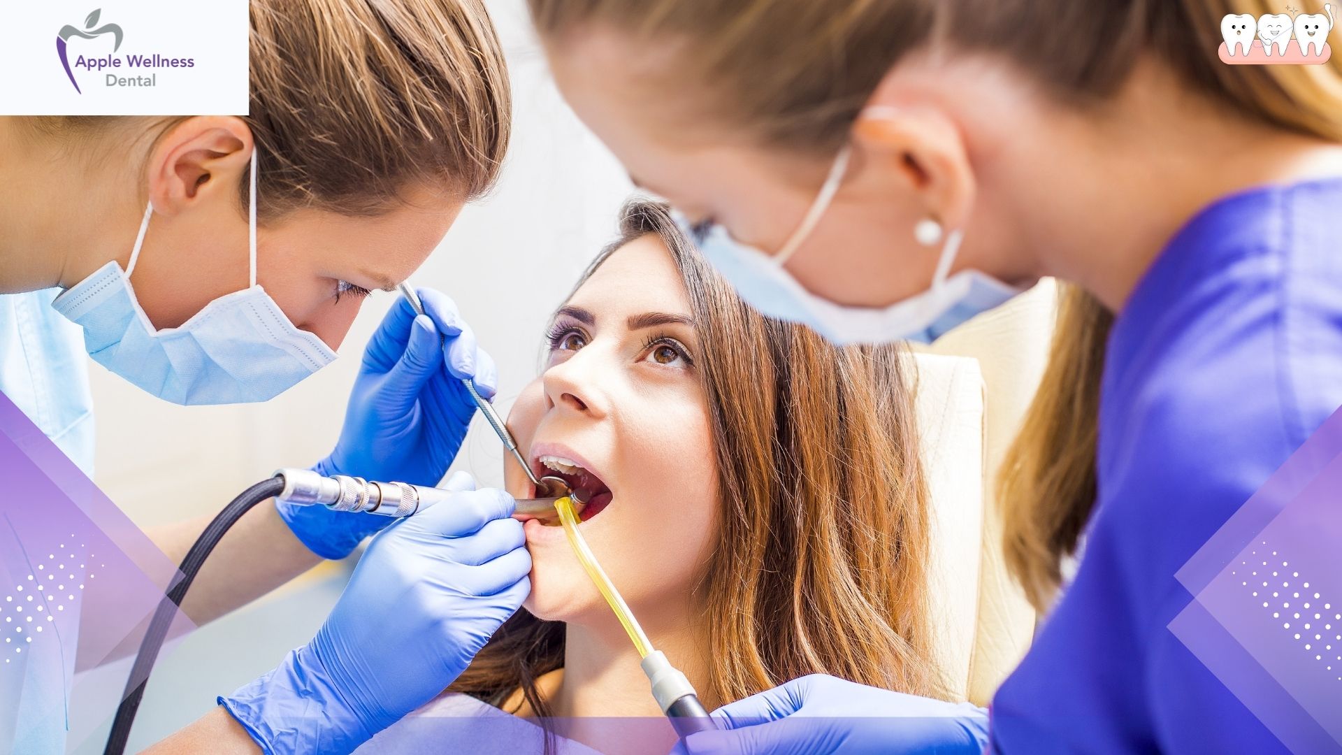 What Are Dentist Fillings and How Do They Work? Everything You Should Know - Apple Wellness Dental