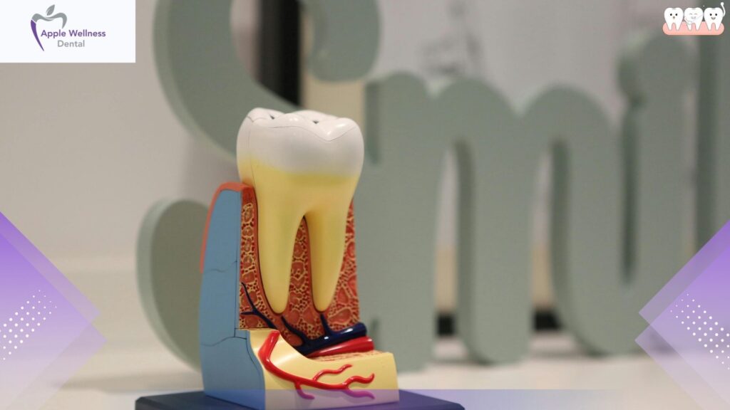 Discover What is Dental Nerve Damage at Apple Wellness Dental - Apple Wellness Dental