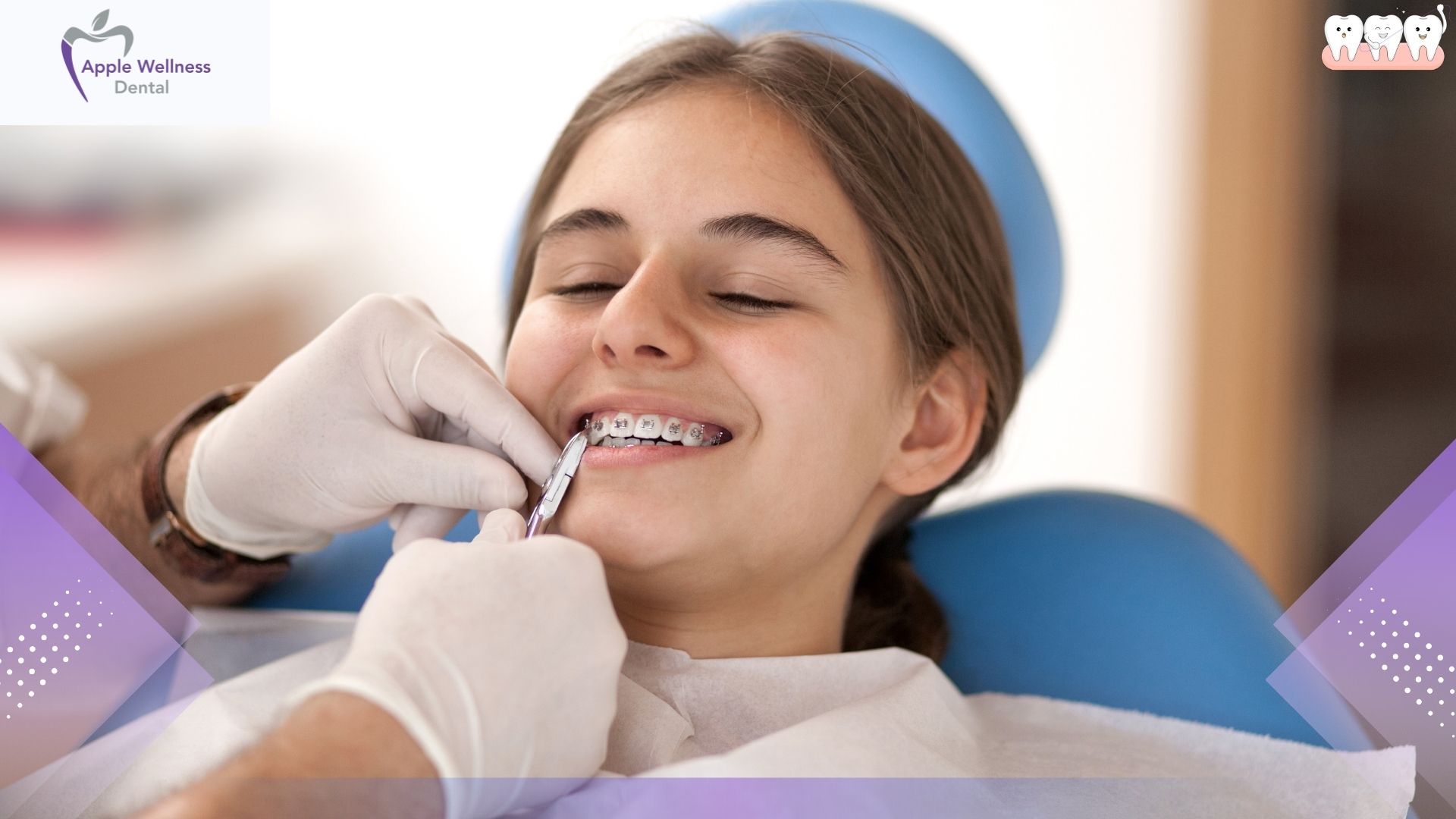 How Do You Manage Dental Anxiety Before Seeing a Dentist - Apple Wellness Dental