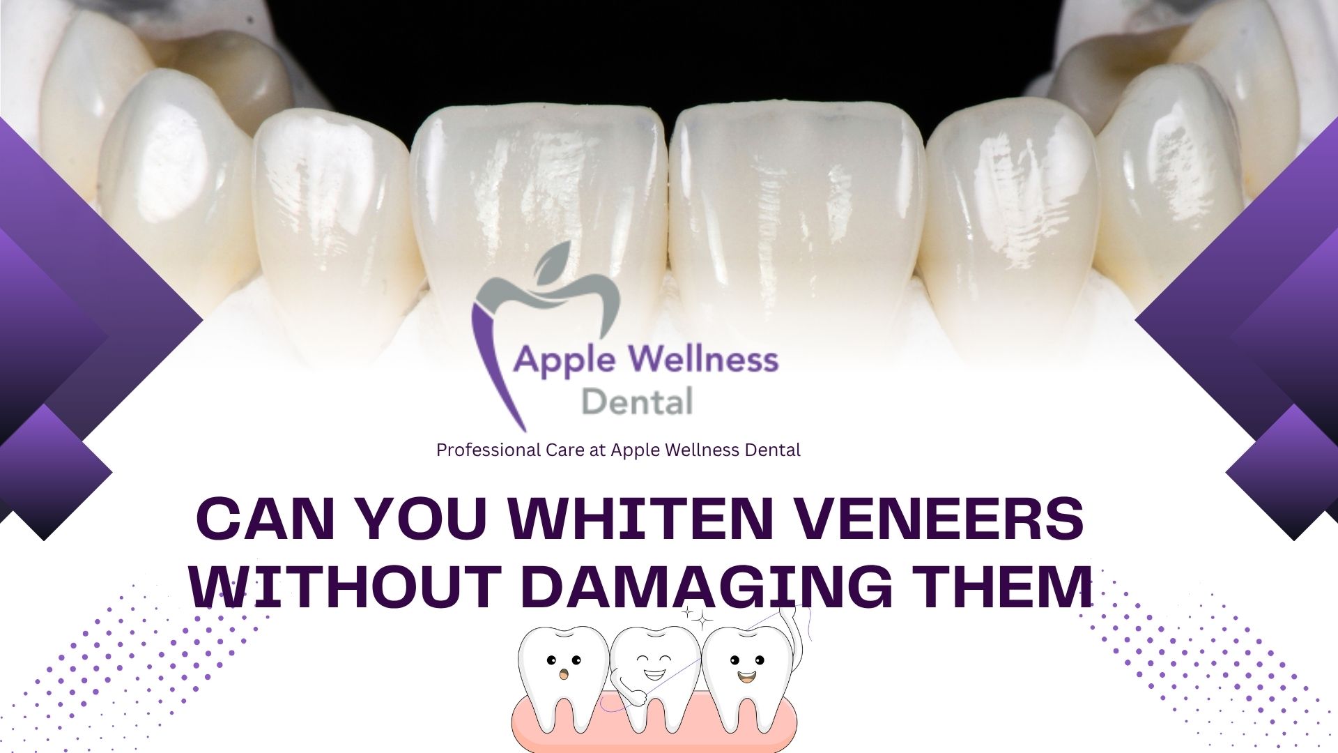 Can You Whiten Veneers Without Damaging Them - Apple Wellness Dental