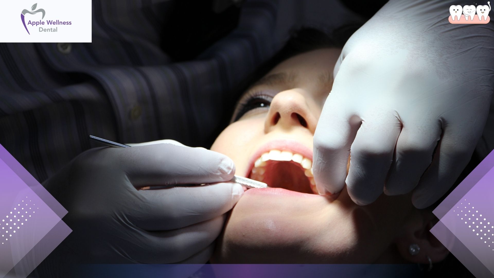 What Are the Risks of Not Visiting a Dentist? - Apple Wellness Dental
