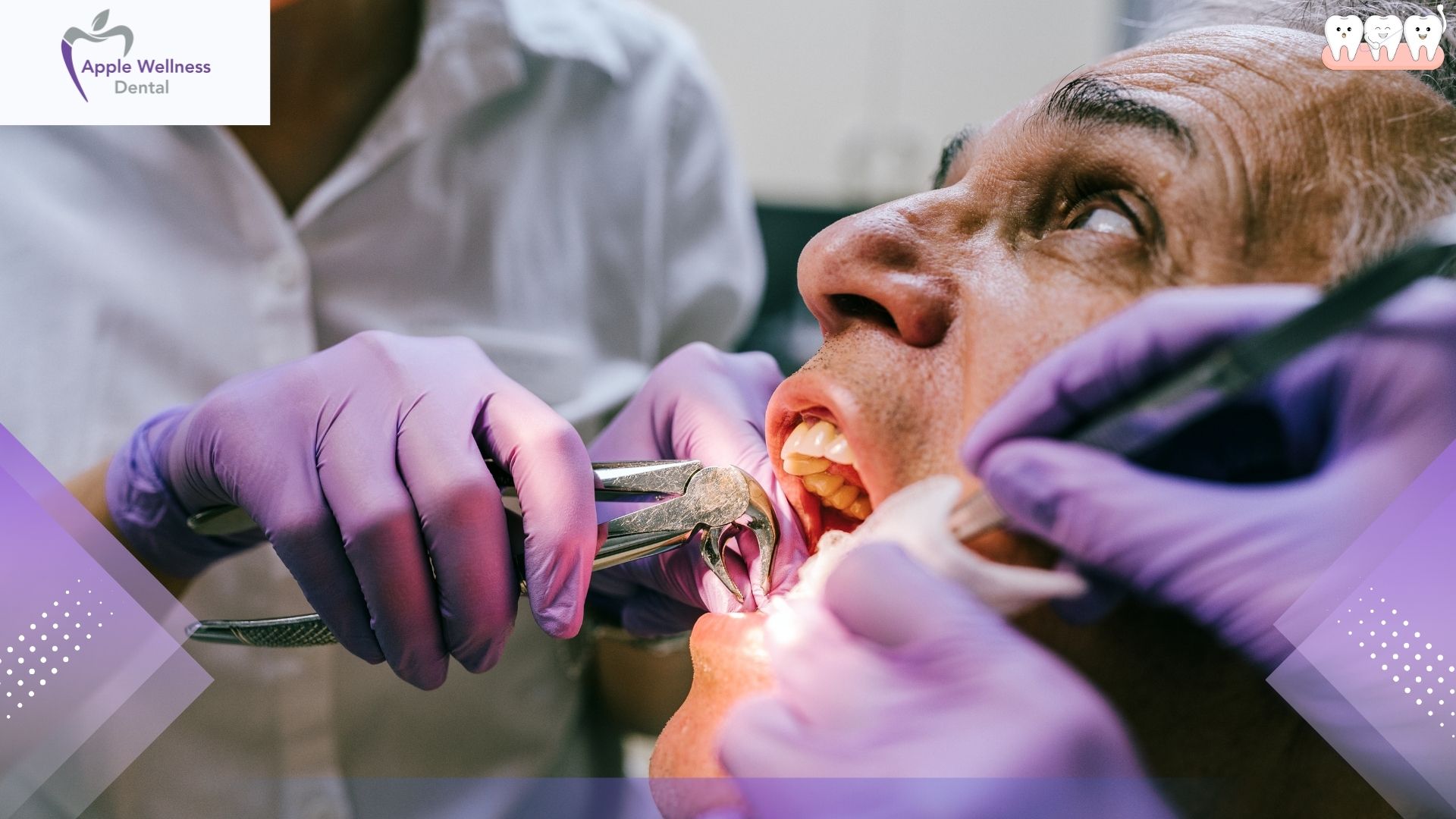 What to Eat After Wisdom Tooth Extraction for a Smooth Recovery - Apple Wellness Dental What to Eat After Wisdom Tooth Extraction for a Smooth Recovery - Apple Wellness Dental