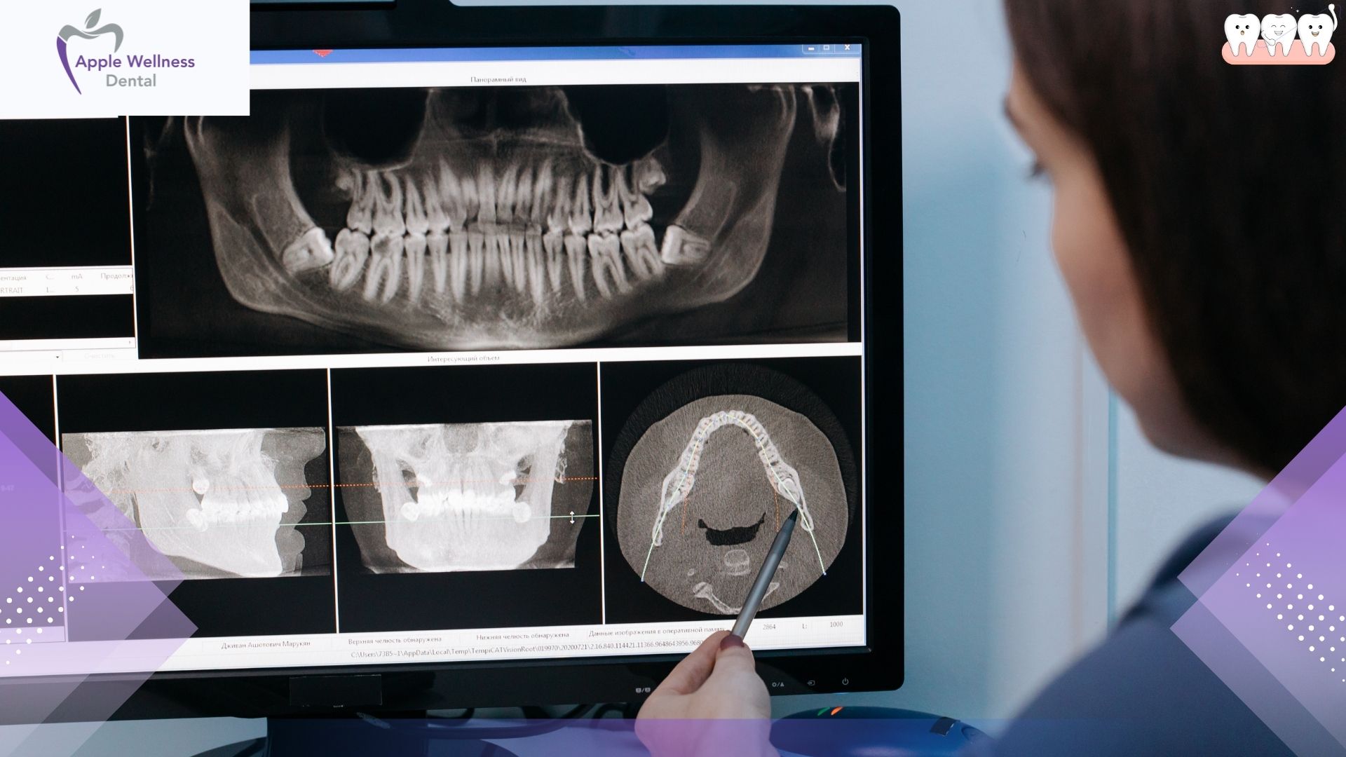 What Are the Risks of Not Visiting a Dentist in Airdrie? - Apple Wellness Dental