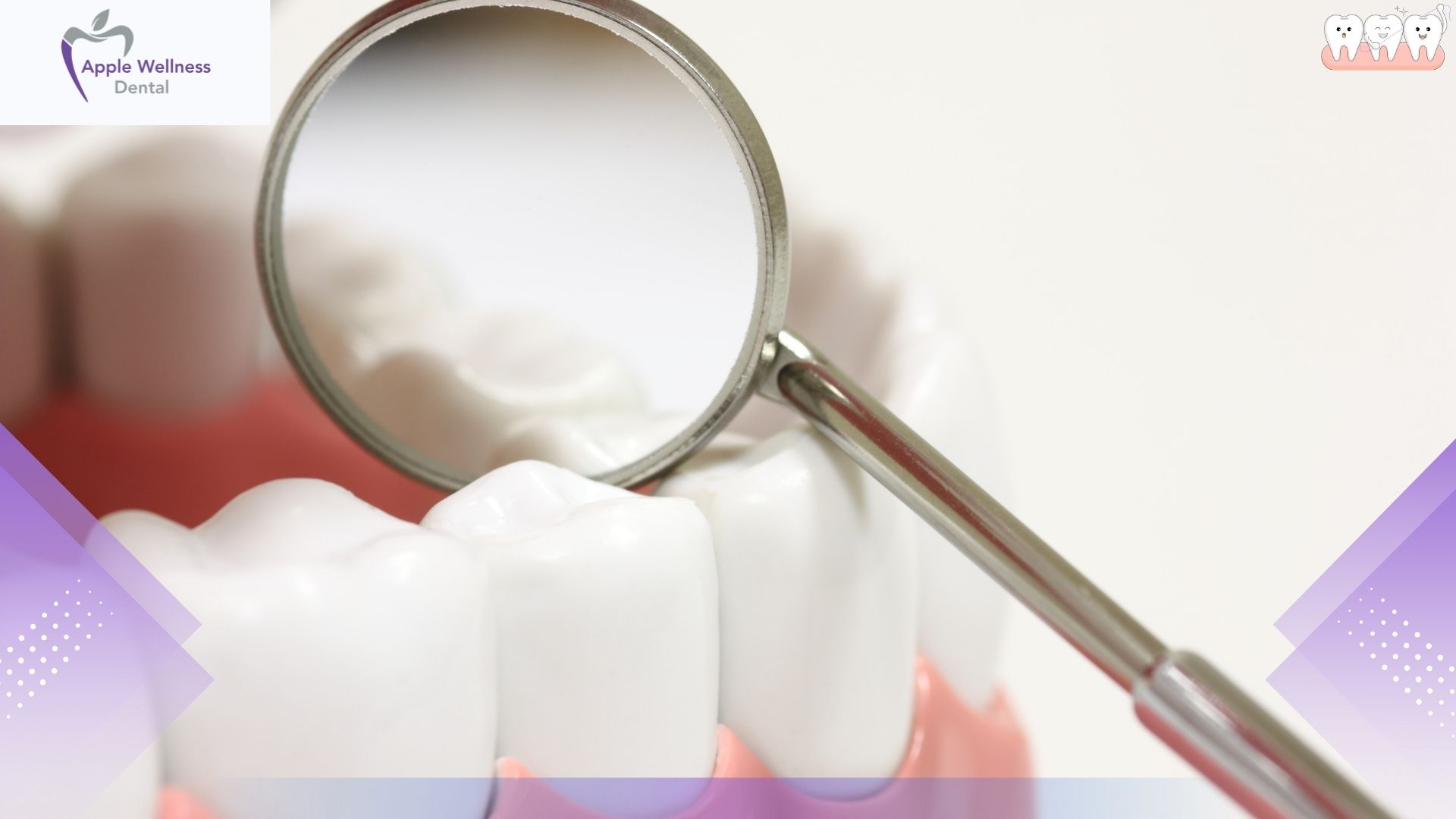 How Long Do Cosmetic Dentistry Results Last in Airdrie? - Apple Wellness Dental