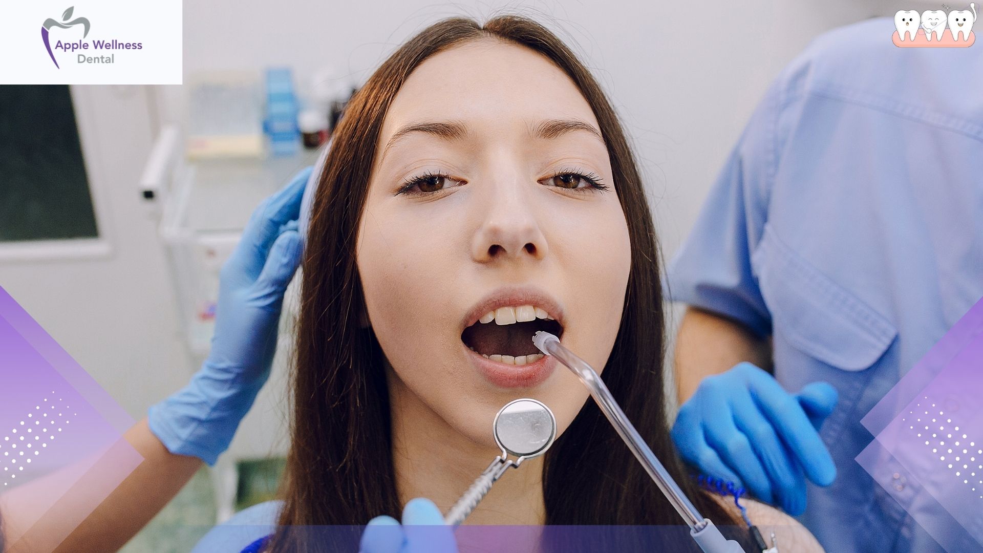 How Does a Dentist Help Prevent Cavities? Expert Guide - Apple Wellness Dental