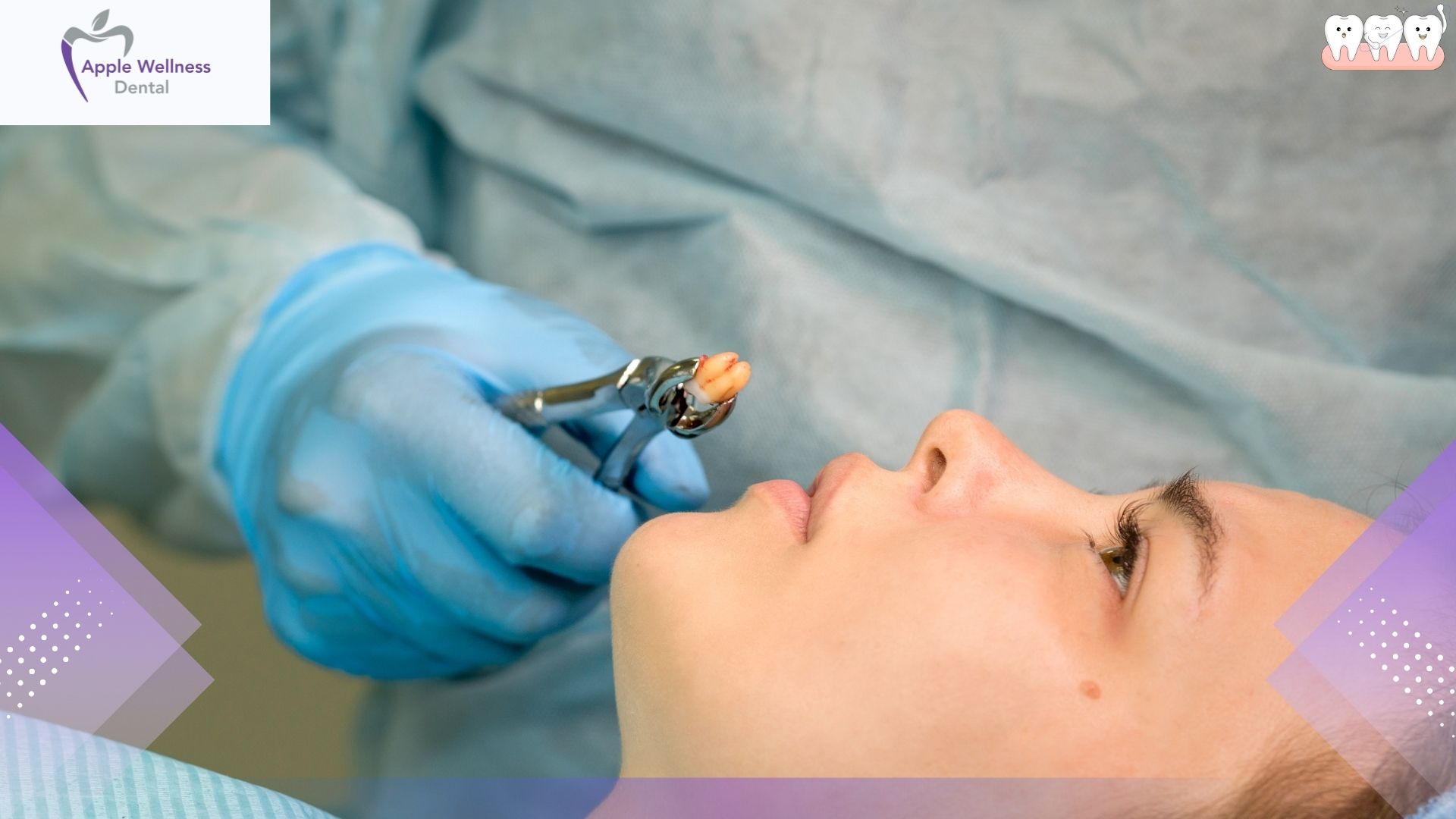 When Can I Have Carbonation After Wisdom Tooth Extraction? - Apple Wellness Dental
