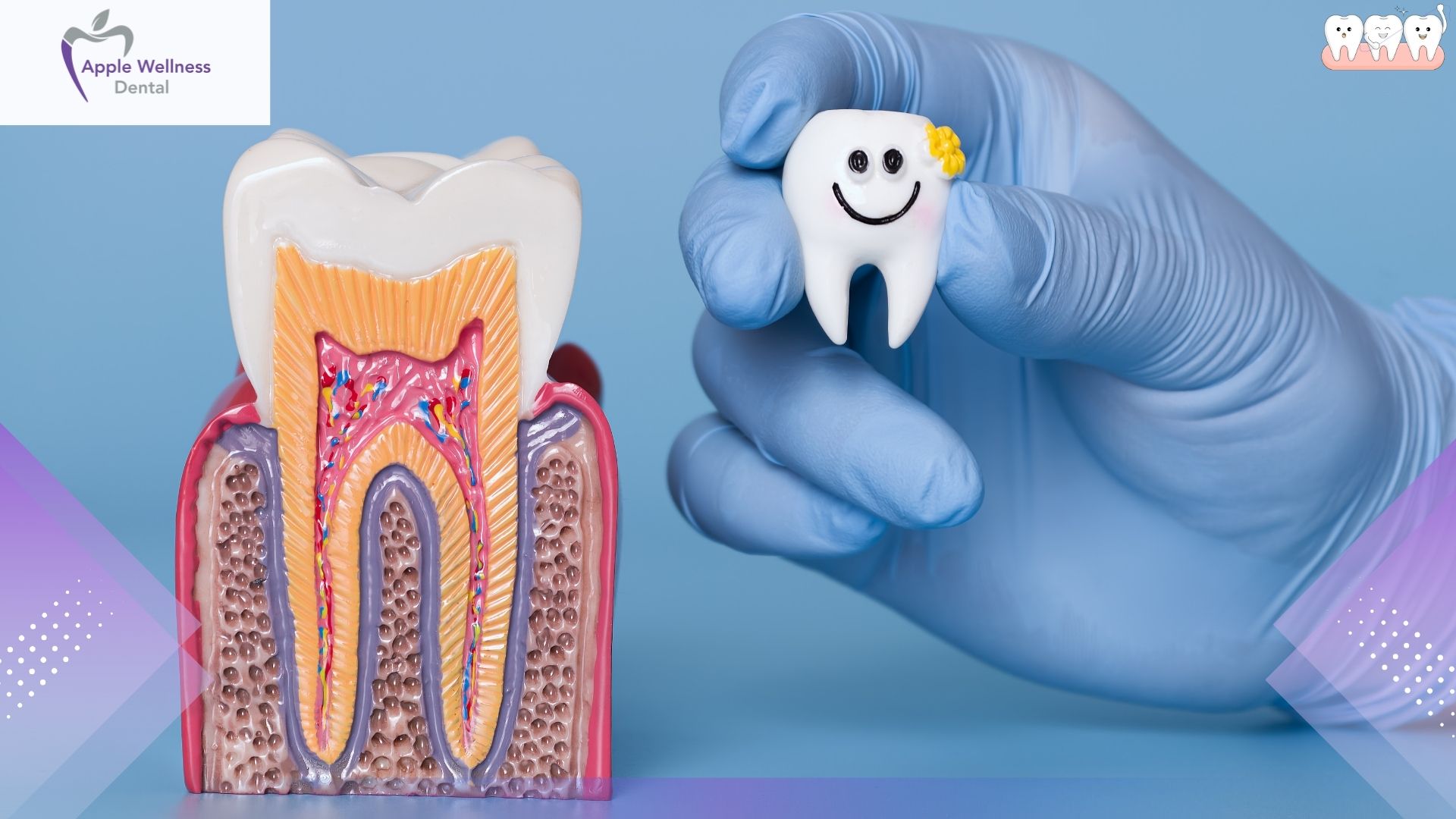 How Are Bridges Built to Restore Missing Teeth - Apple Wellness Dental