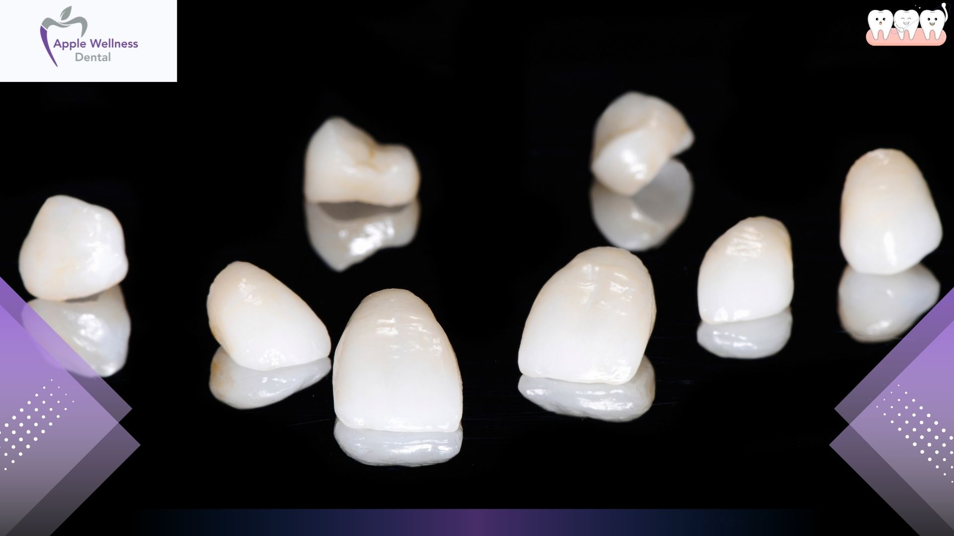 Can You Whiten Veneers Without Damaging Them - Apple Wellness Dental