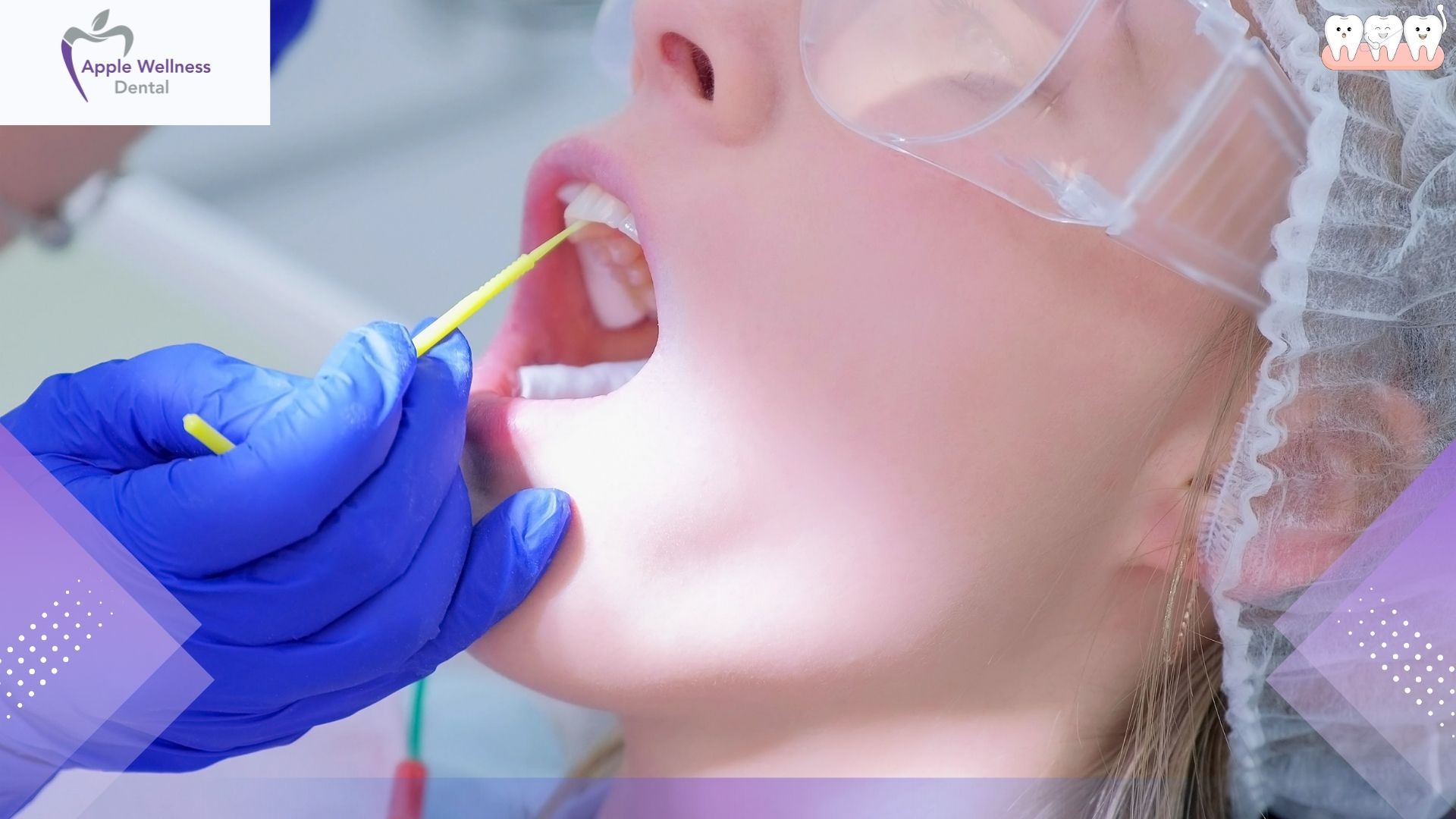 What Happens During a Hygiene Therapy Appointment in Airdrie - Apple Wellness Dental