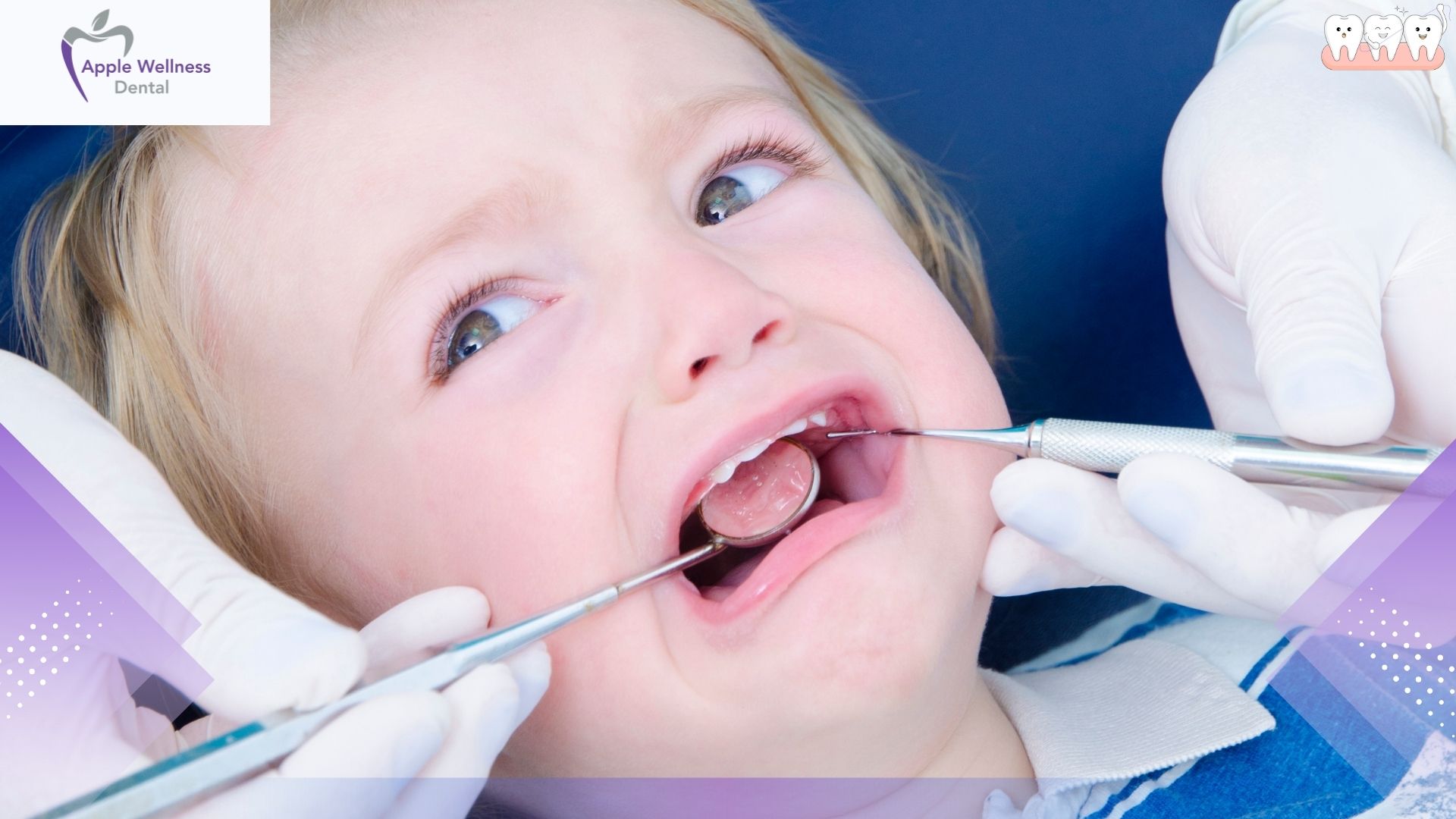 When Should Kids Start Seeing a Dentist in Airdrie - Apple Wellness Dental