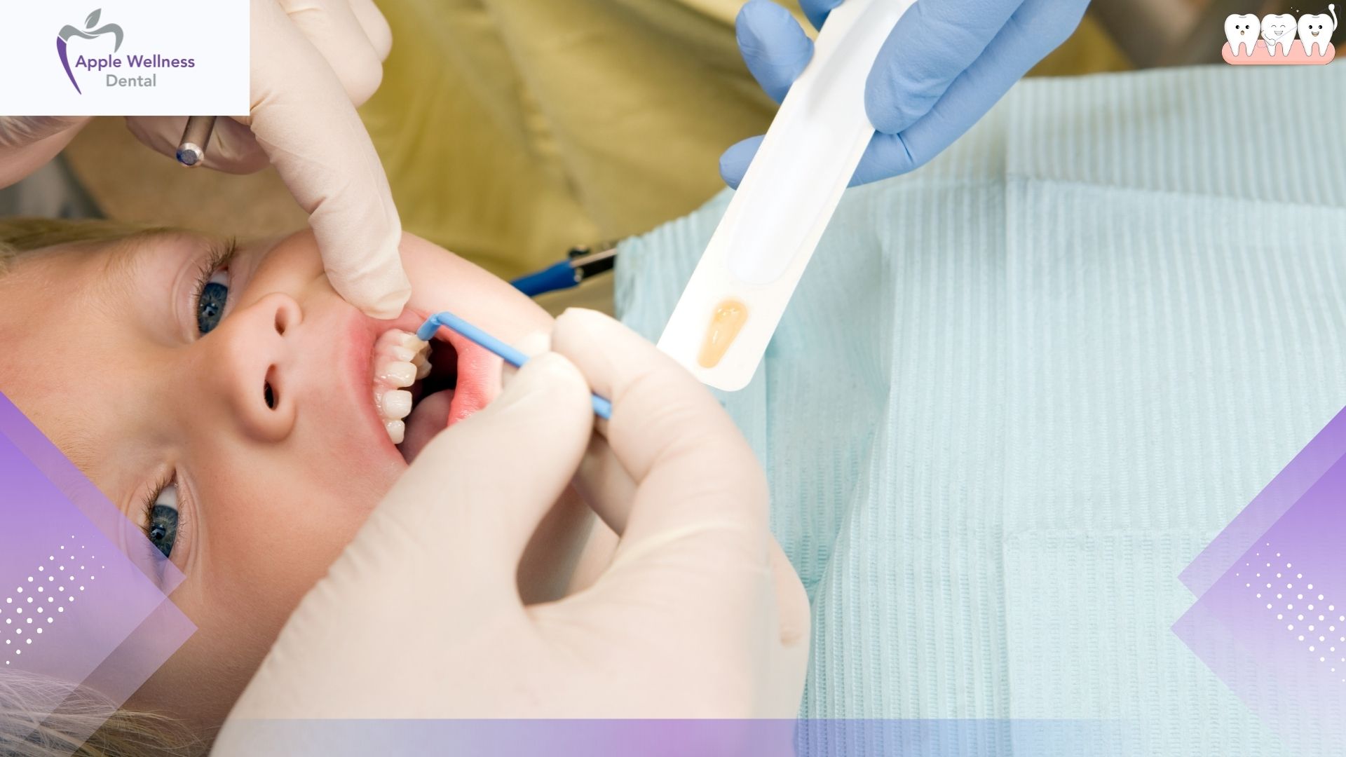 What Happens During a Hygiene Therapy Appointment in Airdrie - Apple Wellness Dental