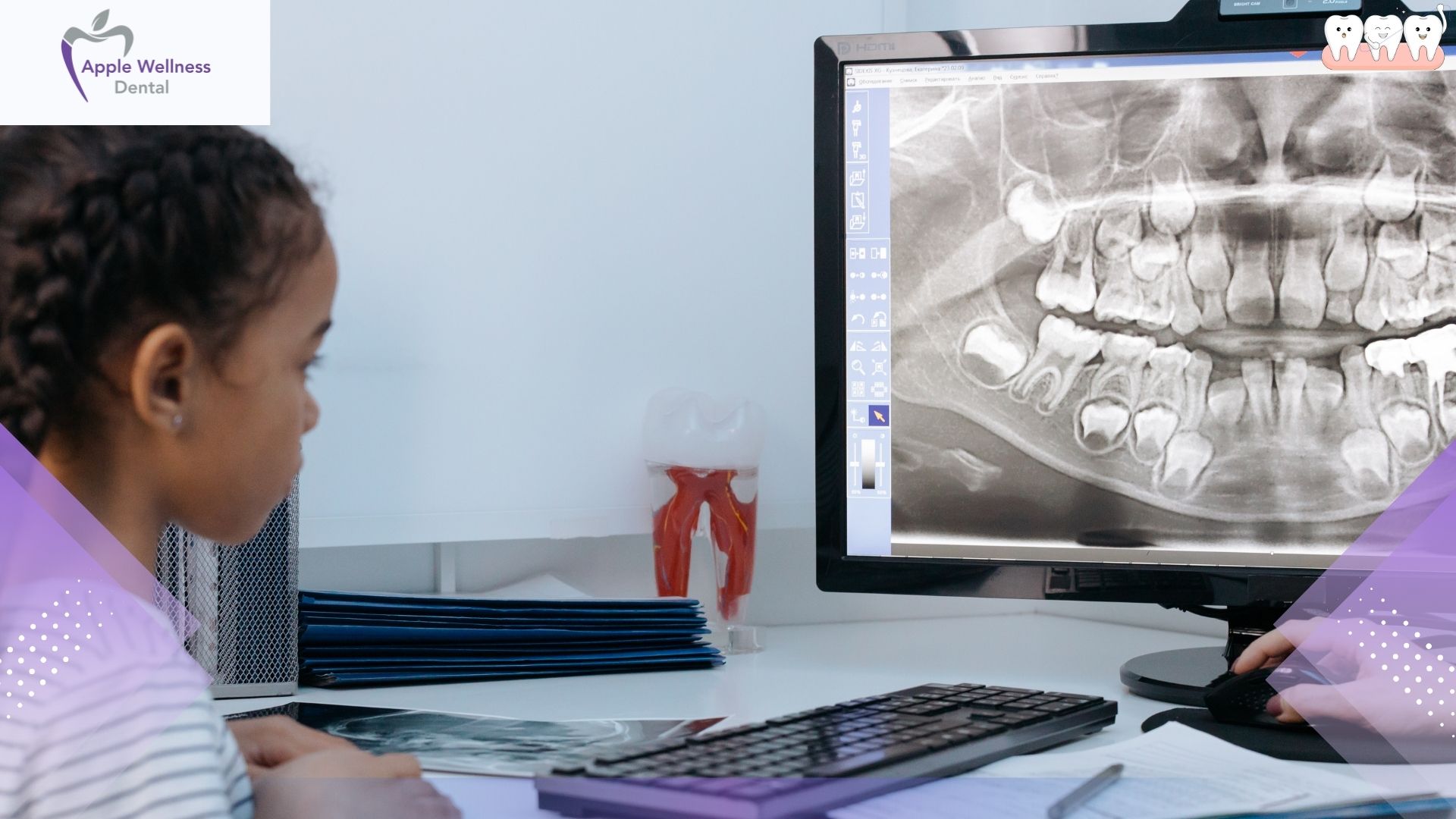 How Do Dentists Help Children with Dental Anxiety Effectively - Apple Wellness Dental