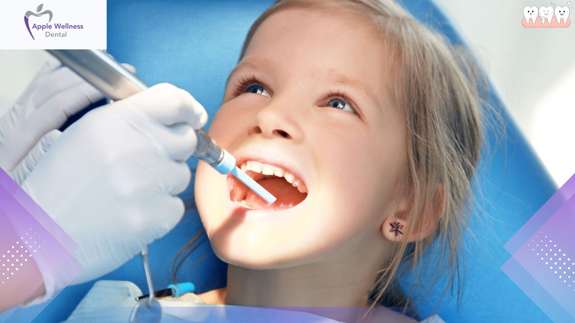 When Should Kids Start Seeing a Dentist for Care - Apple Wellness Dental