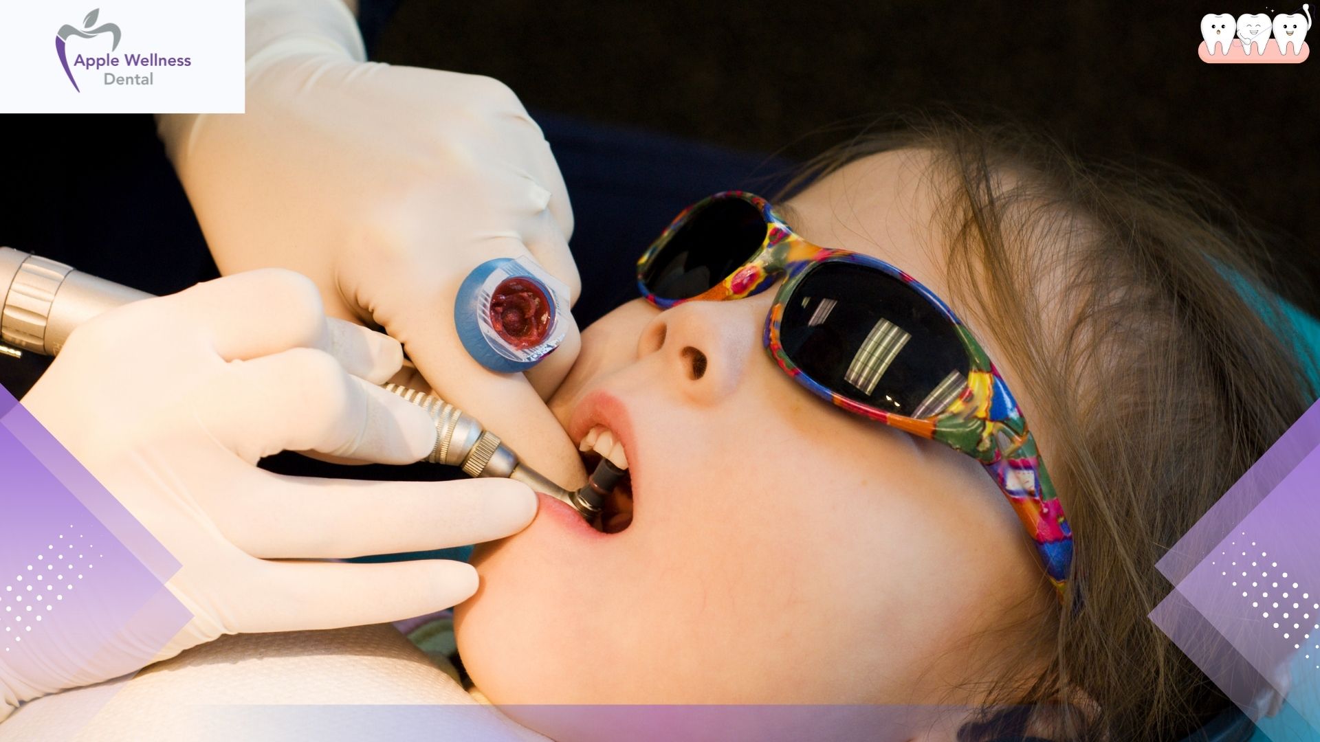 What Is a Dental Emergency and When to Seek Help - Apple Wellness Dental