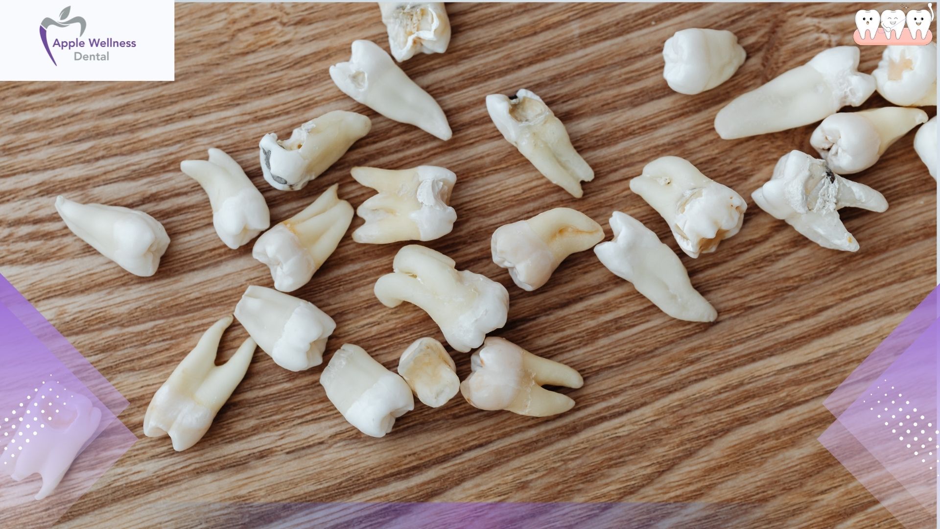 When Is a Dental Extraction Necessary for Oral Health - Apple Wellness Dental