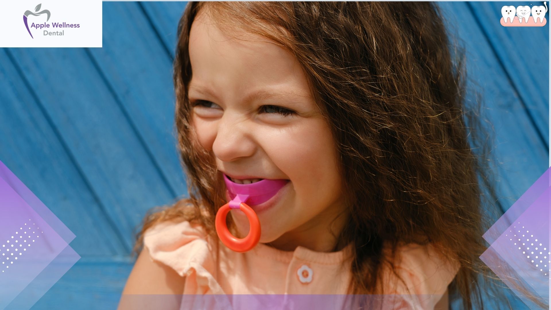 How Long Do Custom Mouthguards Last for Daily Use - Apple Wellness Dental