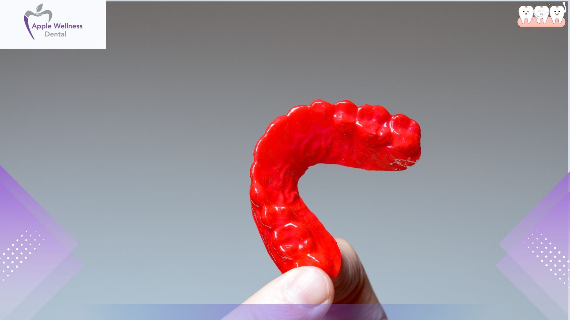 Why Are Custom Mouthguards Better Than Store Bought Options - Apple Wellness Dental
