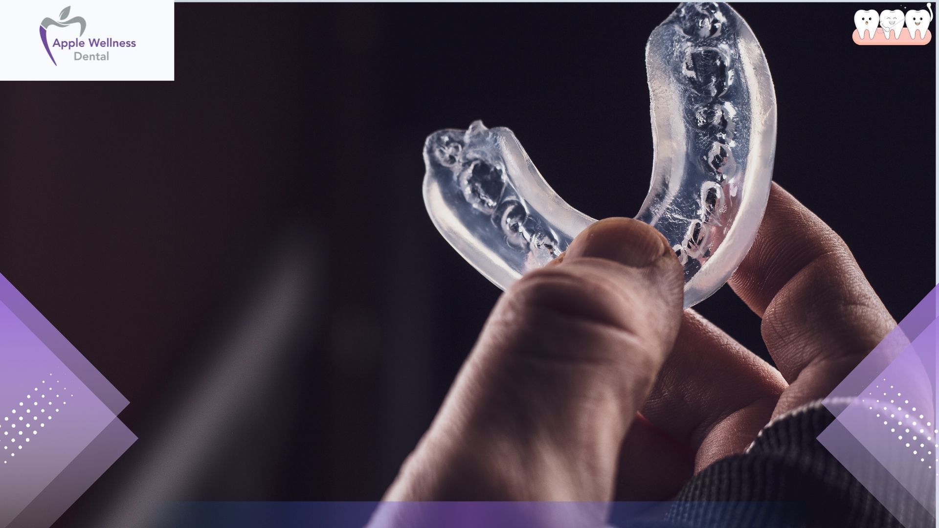 How Long Do Custom Mouthguards Last in Airdrie Patients - Apple Wellness Dental
