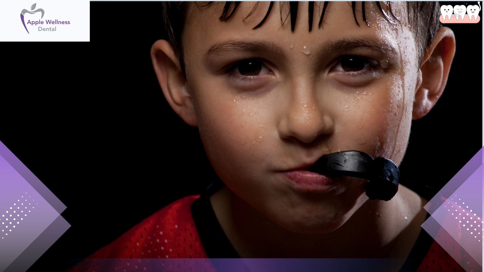 How Are Custom Mouthguards Made for Your Unique Smile - Apple Wellness Dental