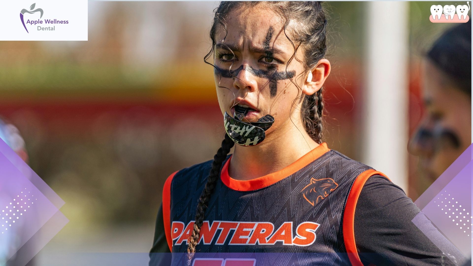 What Sports Require Custom Mouthguards in Airdrie Areas - Apple Wellness Dental