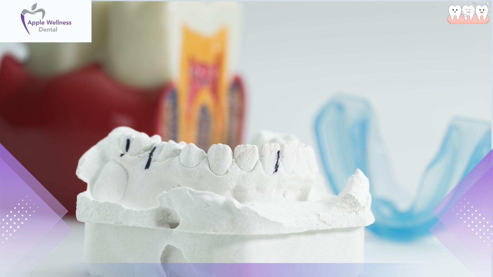 Why Are Custom Mouthguards Better Than Store Bought in Airdrie - Apple Wellness Dental