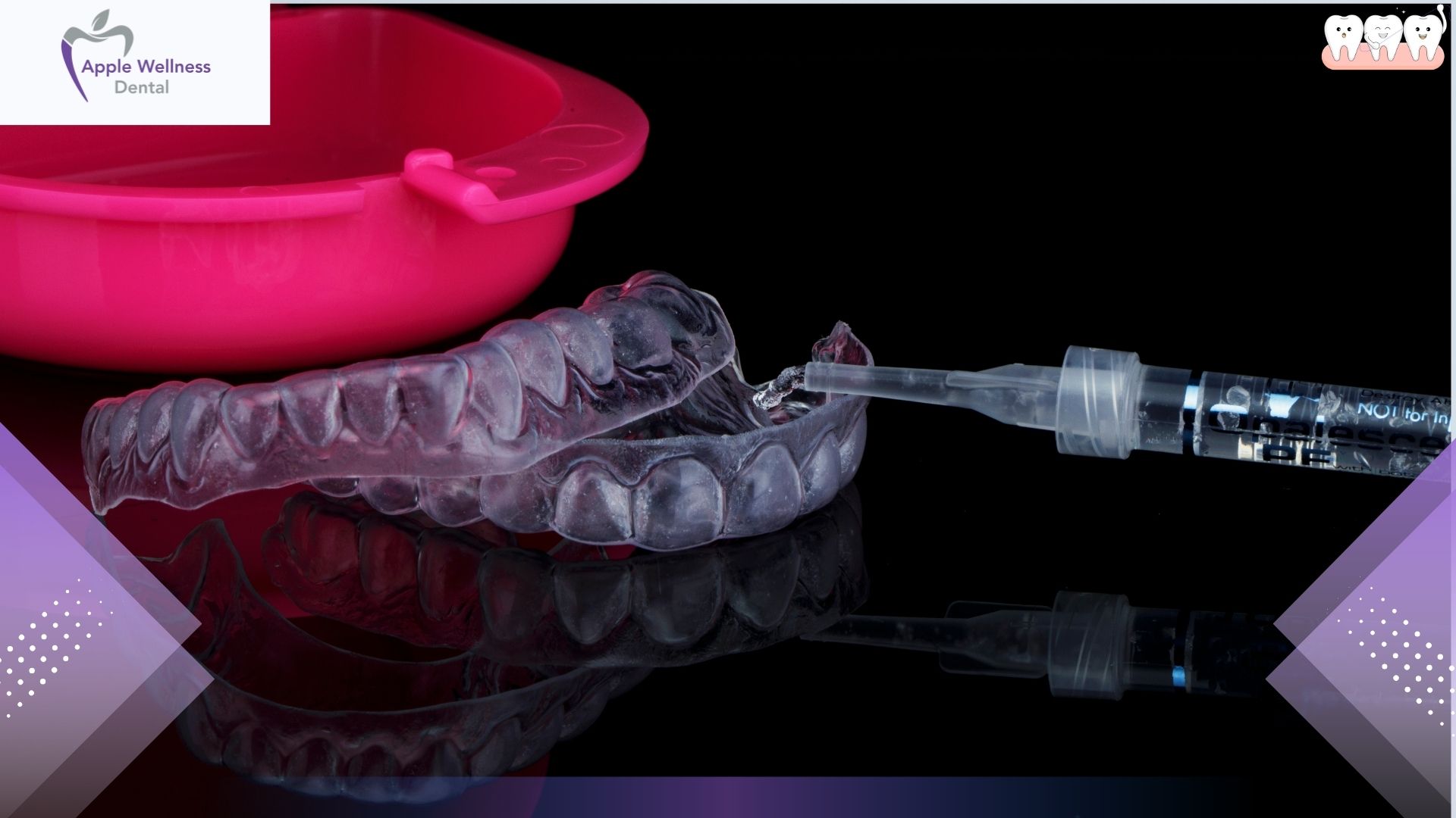 How Are Custom Mouthguards Made in Airdrie for You - Apple Wellness Dental