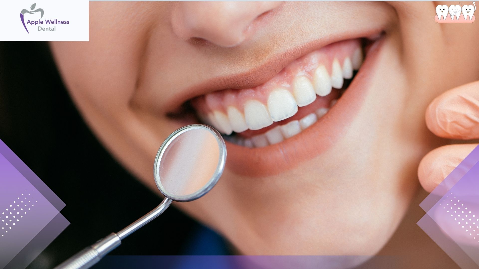 What to Expect During a Dental Extraction: Your Path to a Healthier Smile - Apple Wellness Dental