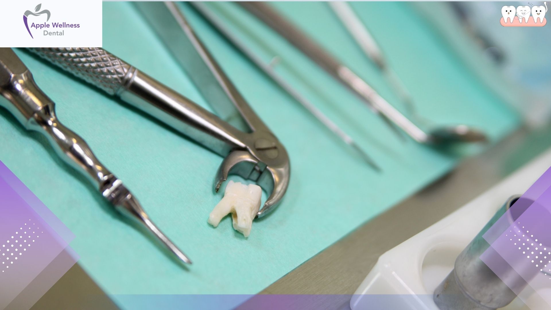 What to Expect During a Dental Extraction in Airdrie: A Complete Guide - Apple Wellness Dental