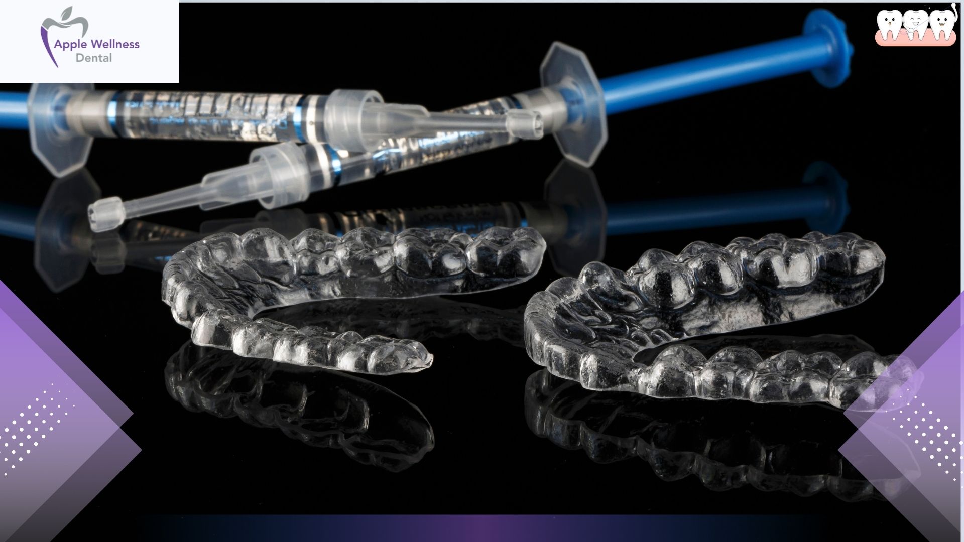 How Long Do Custom Mouthguards Last in Airdrie Patients - Apple Wellness Dental