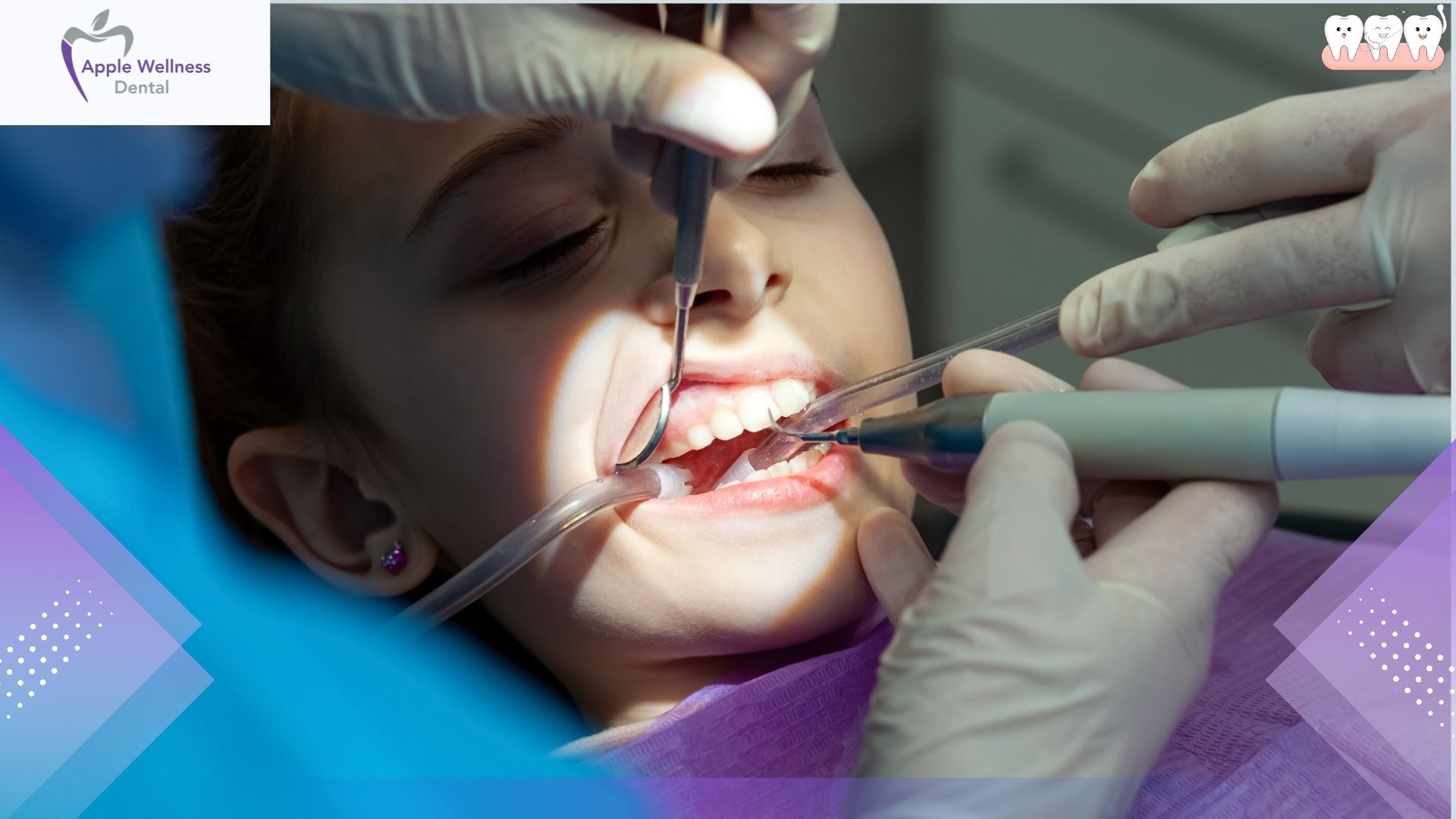 How Do Dentists Treat Knocked Out Teeth Effectively - Apple Wellness Dental