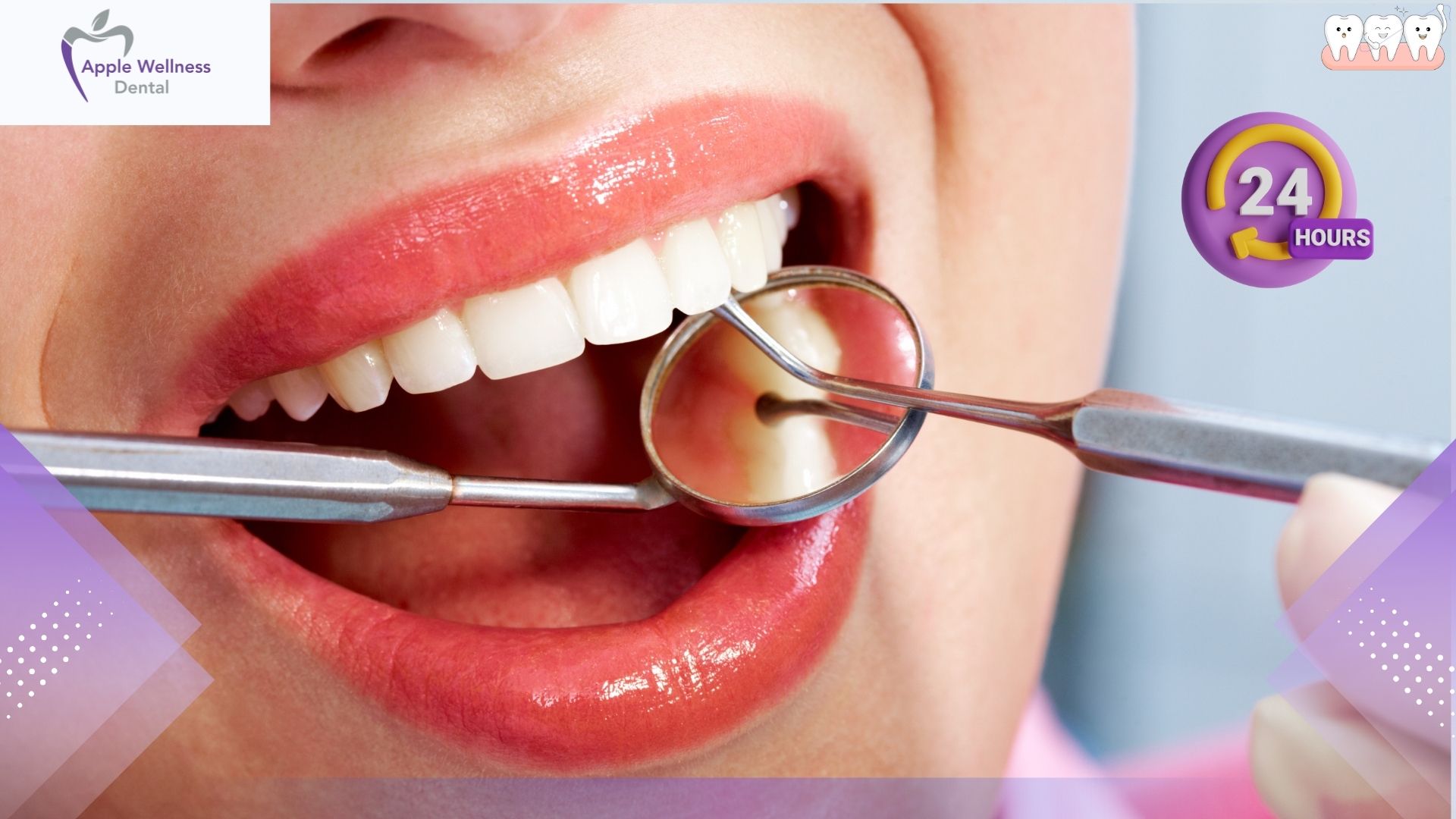 How to Care for Your Mouth After a Dental Extraction: The Ultimate Recovery Guide - Apple Wellness Dental