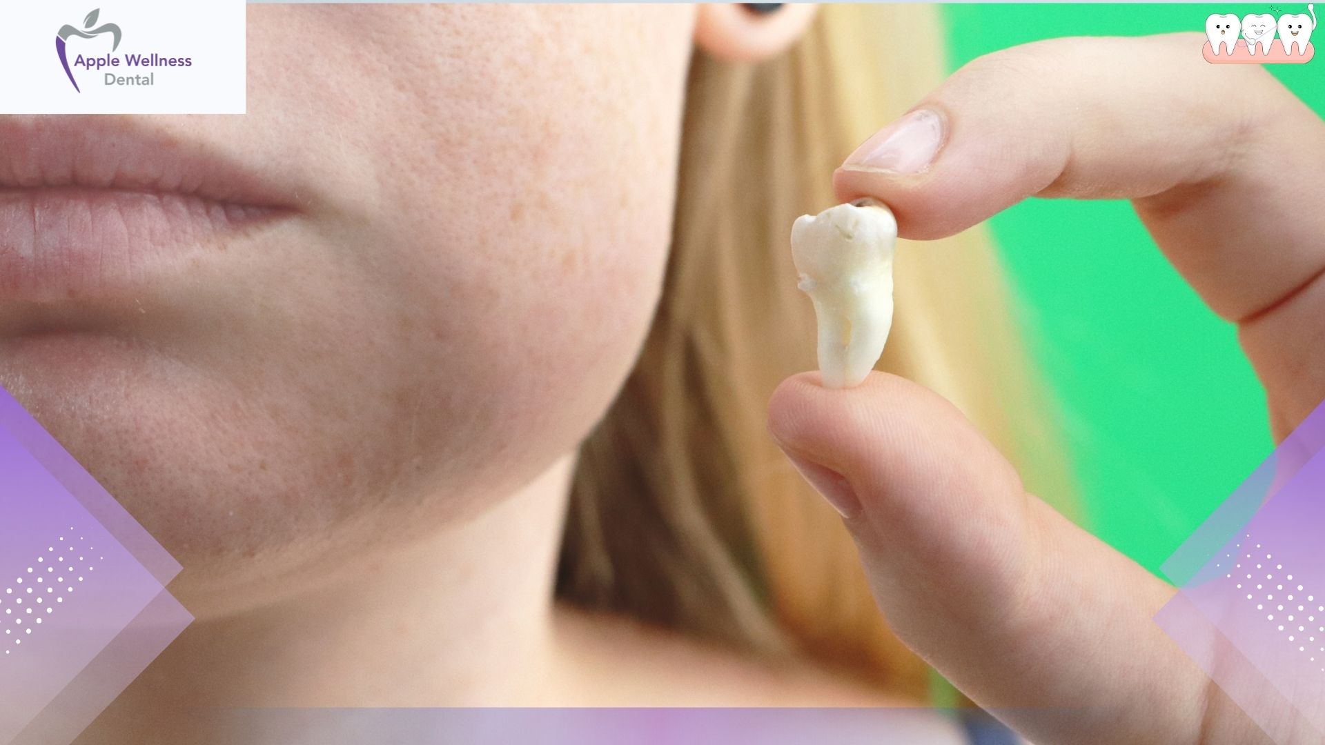 Airdrie Dental Extraction Recovery: Your Complete Aftercare Guide - Apple Wellness Dental