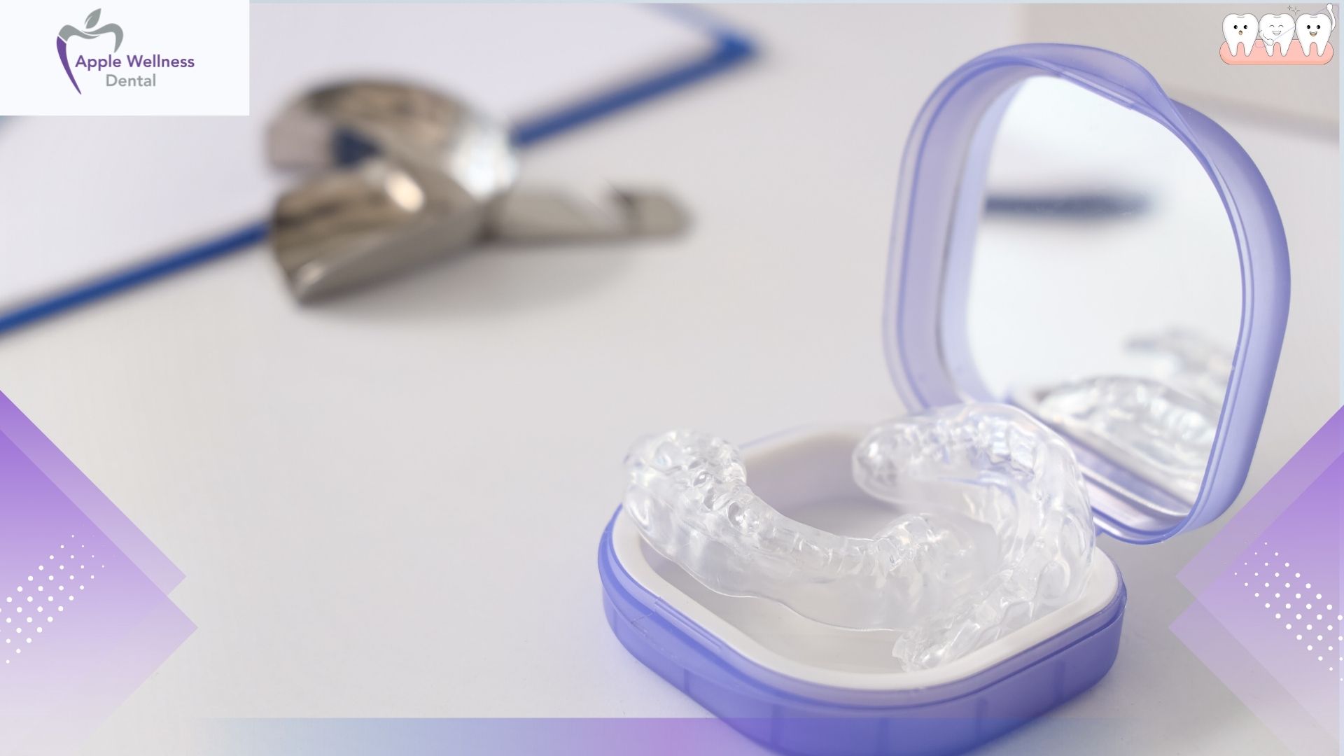 How Are Custom Mouthguards Made in Airdrie for You - Apple Wellness Dental