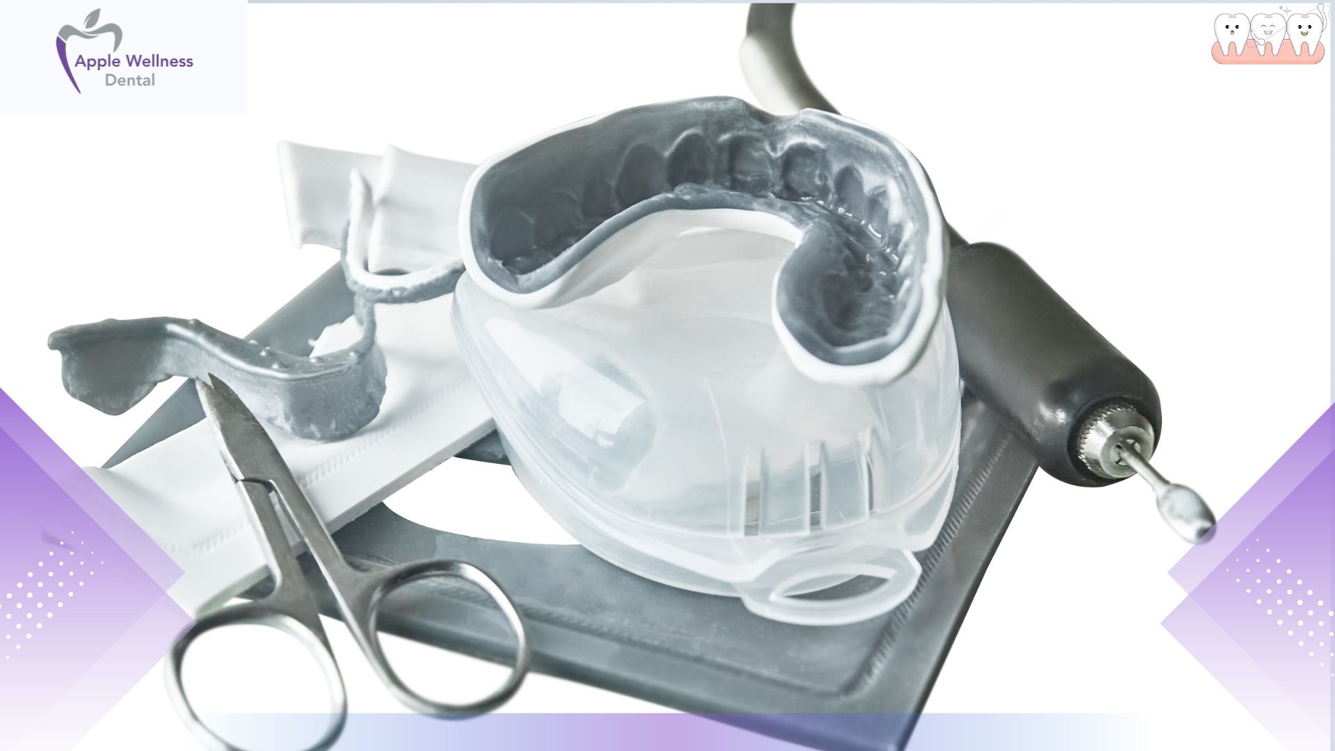 How Long Do Custom Mouthguards Last in Airdrie Patients - Apple Wellness Dental