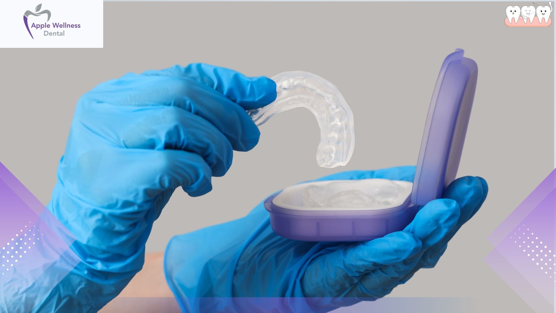 How Are Custom Mouthguards Made in Airdrie for You - Apple Wellness Dental