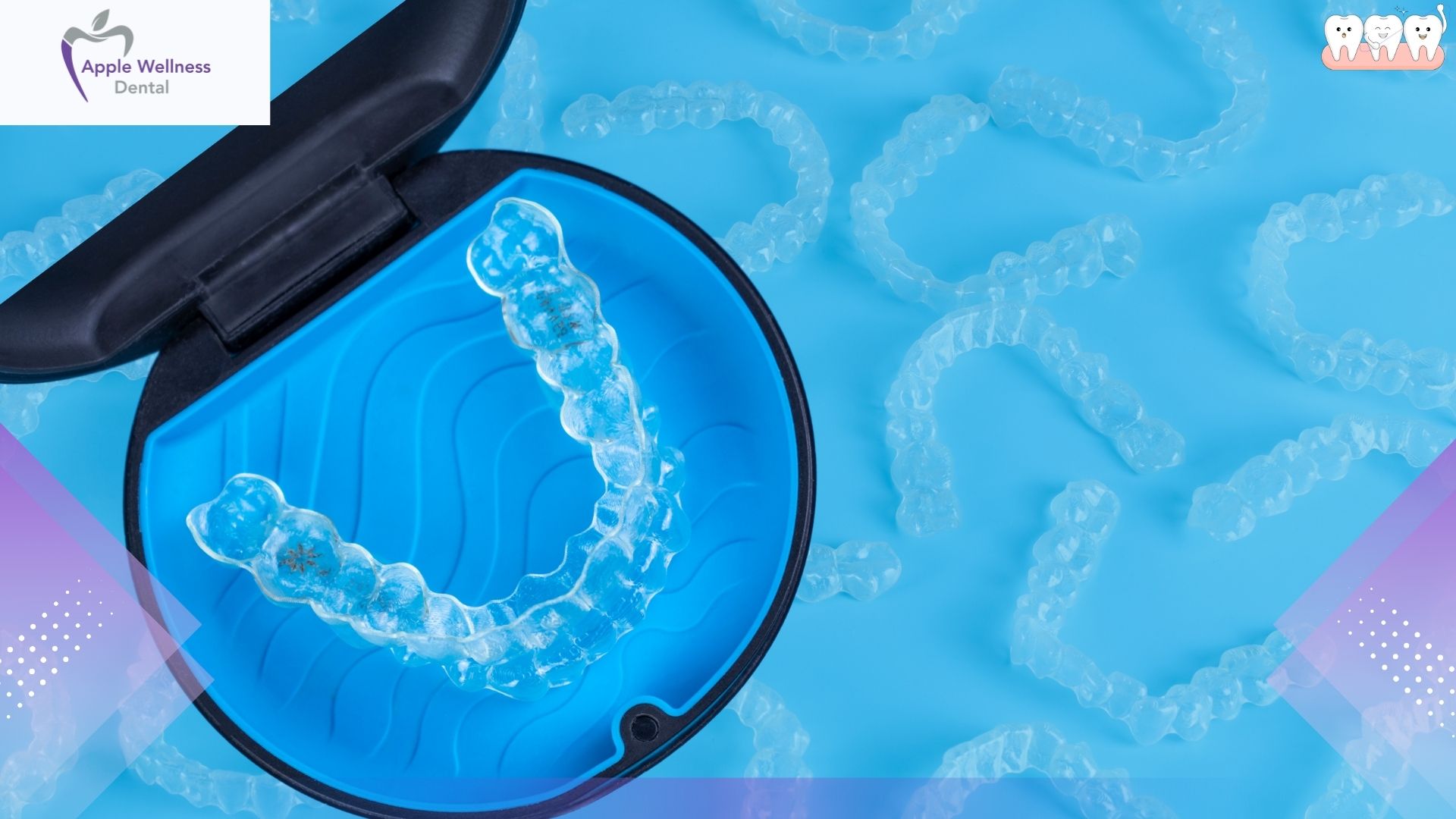 What Should You Do If You Lose a Filling in Airdrie - Apple Wellness Dental What Should You Do If You Lose a Filling in Airdrie - Apple Wellness Dental