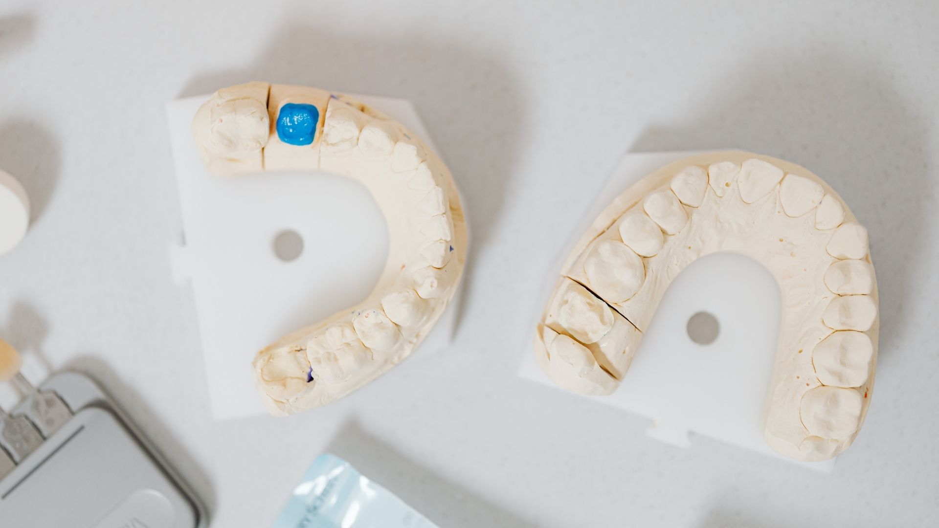 What Should You Do If You Lose a Filling - Apple Wellness Dental What Should You Do If You Lose a Filling - Apple Wellness Dental