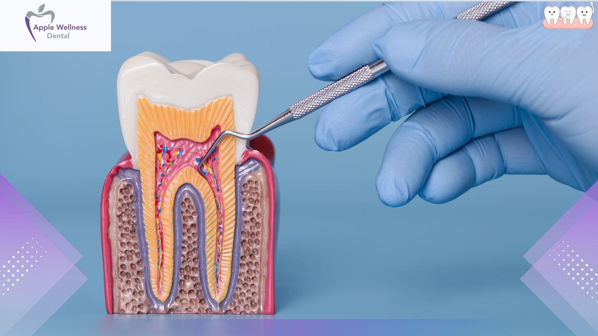 Airdrie Dental Implant Guide: How We Restore Your Smile from the Roots Up - Apple Wellness Dental