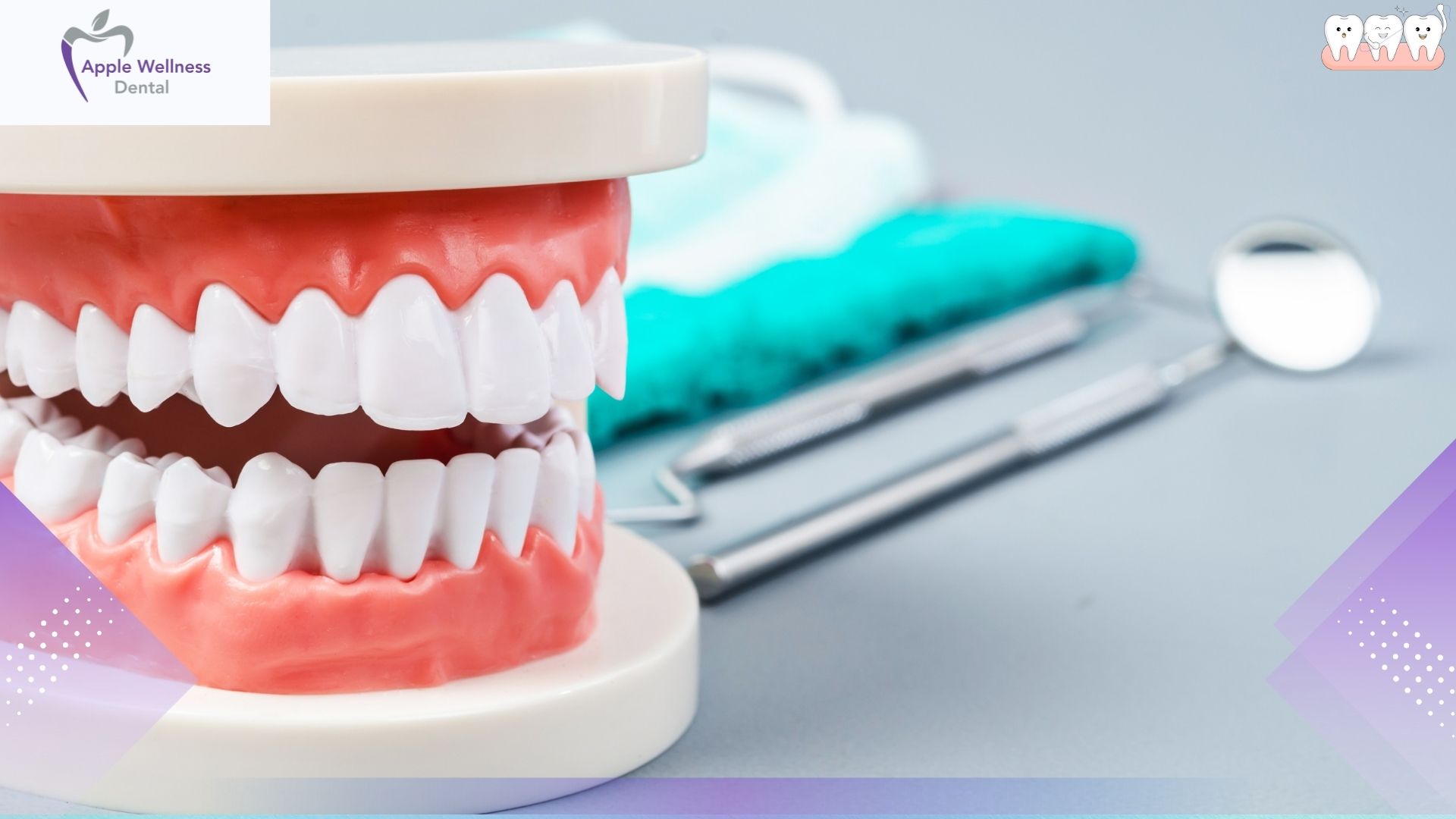 When Are Crowns and Bridges Recommended? A Patient Guide - Apple Wellness Dental