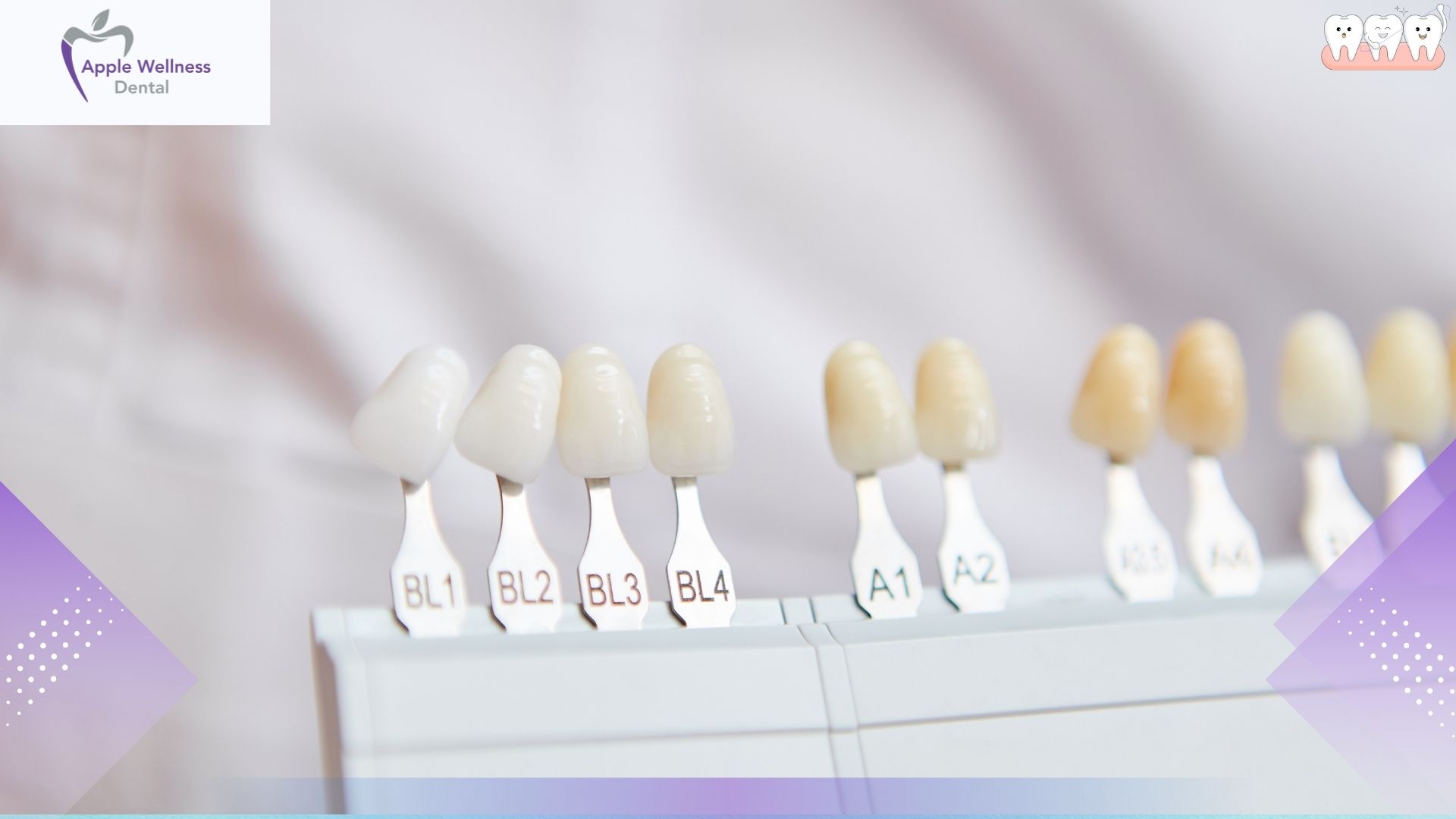 How Does Professional Teeth Whitening Work in Airdrie - Apple Wellness Dental How Does Professional Teeth Whitening Work in Airdrie - Apple Wellness Dental