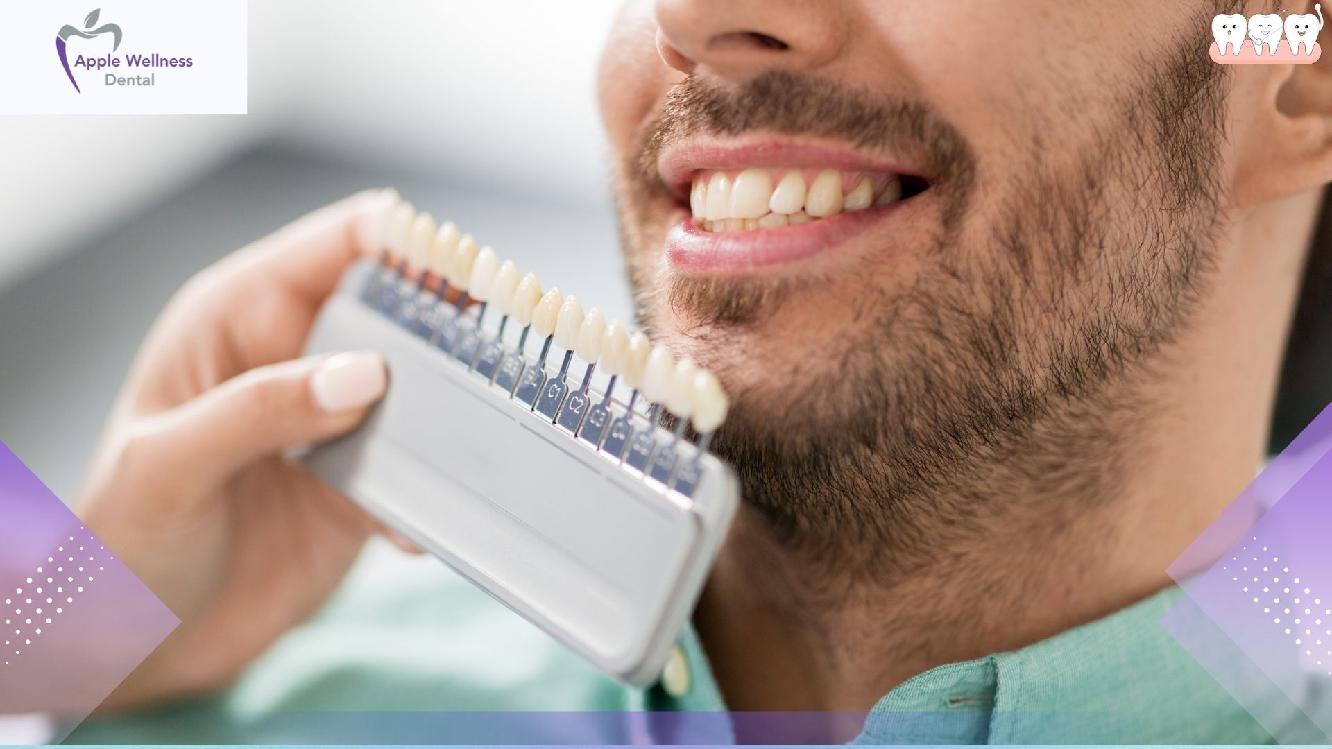 How Does Professional Teeth Whitening Work in Airdrie - Apple Wellness Dental How Does Professional Teeth Whitening Work in Airdrie - Apple Wellness Dental
