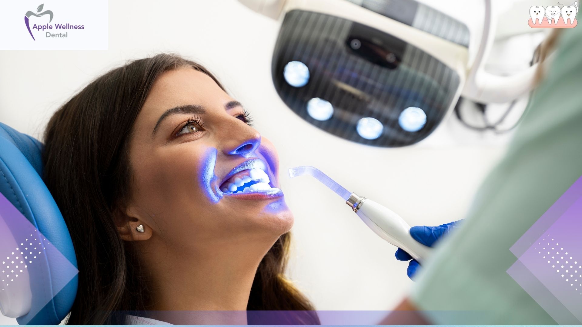How Does Professional Teeth Whitening Work - Apple Wellness Dental