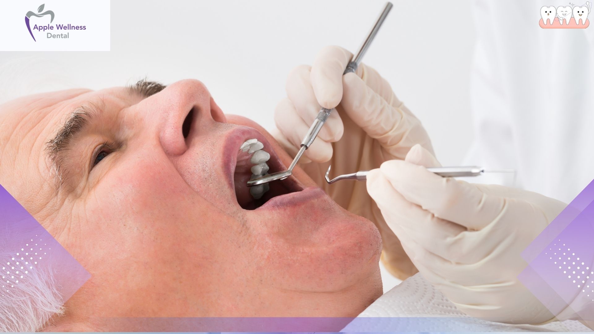 The Truth About Root Canal Pain and Recovery - Apple Wellness Dental The Truth About Root Canal Pain and Recovery - Apple Wellness Dental