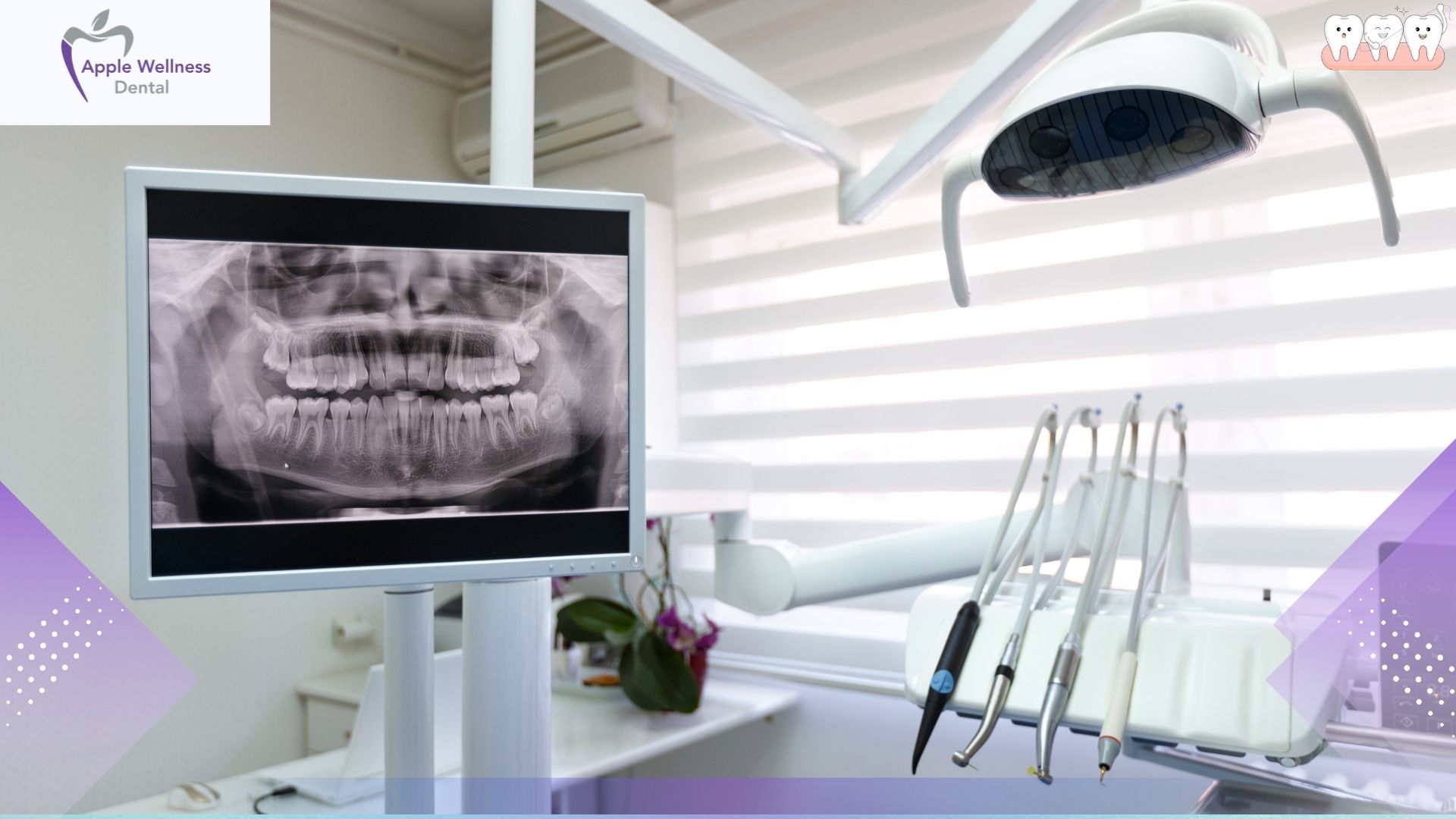 Is Teeth Whitening Safe for Sensitive Teeth in Airdrie? Expert Guide - Apple Wellness Dental