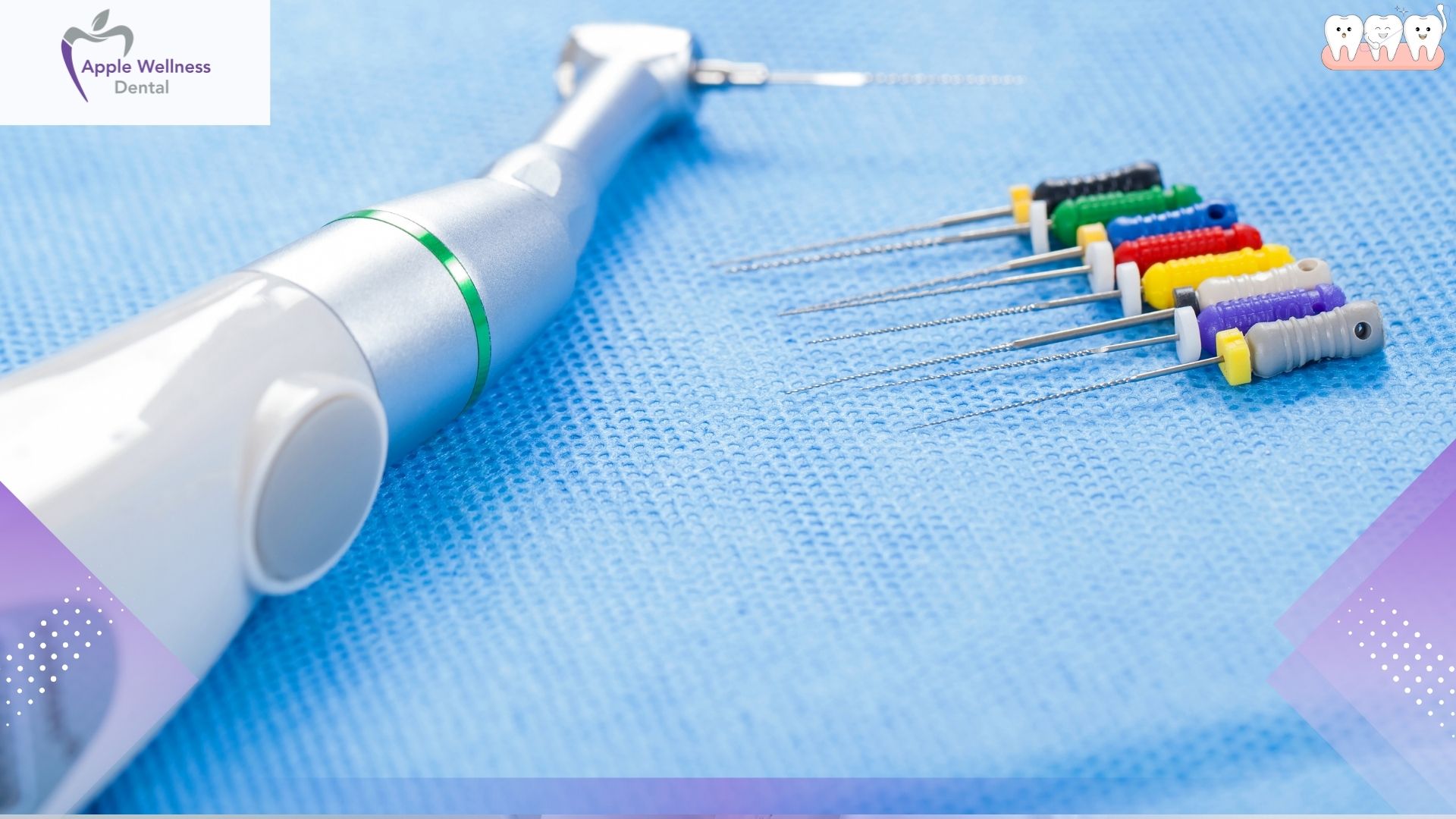 How Long Does a Root Canal Procedure Take in Airdrie - Apple Wellness Dental