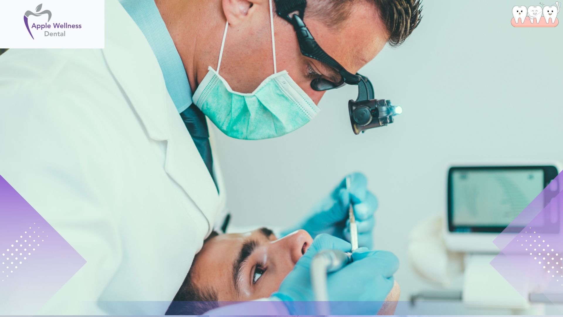 Setting the Schedule: How Long Does a Root Canal Procedure Take? - Apple Wellness Dental