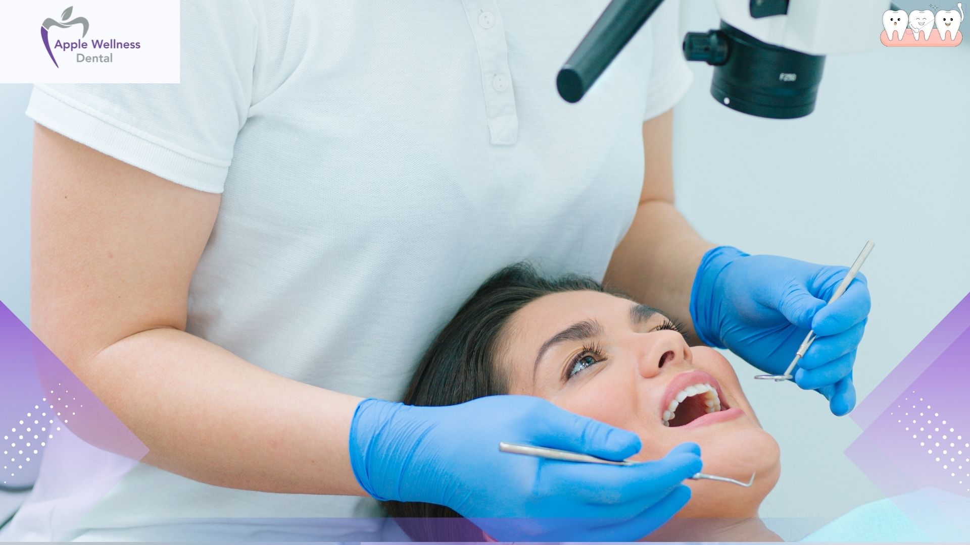 Setting the Schedule: How Long Does a Root Canal Procedure Take? - Apple Wellness Dental