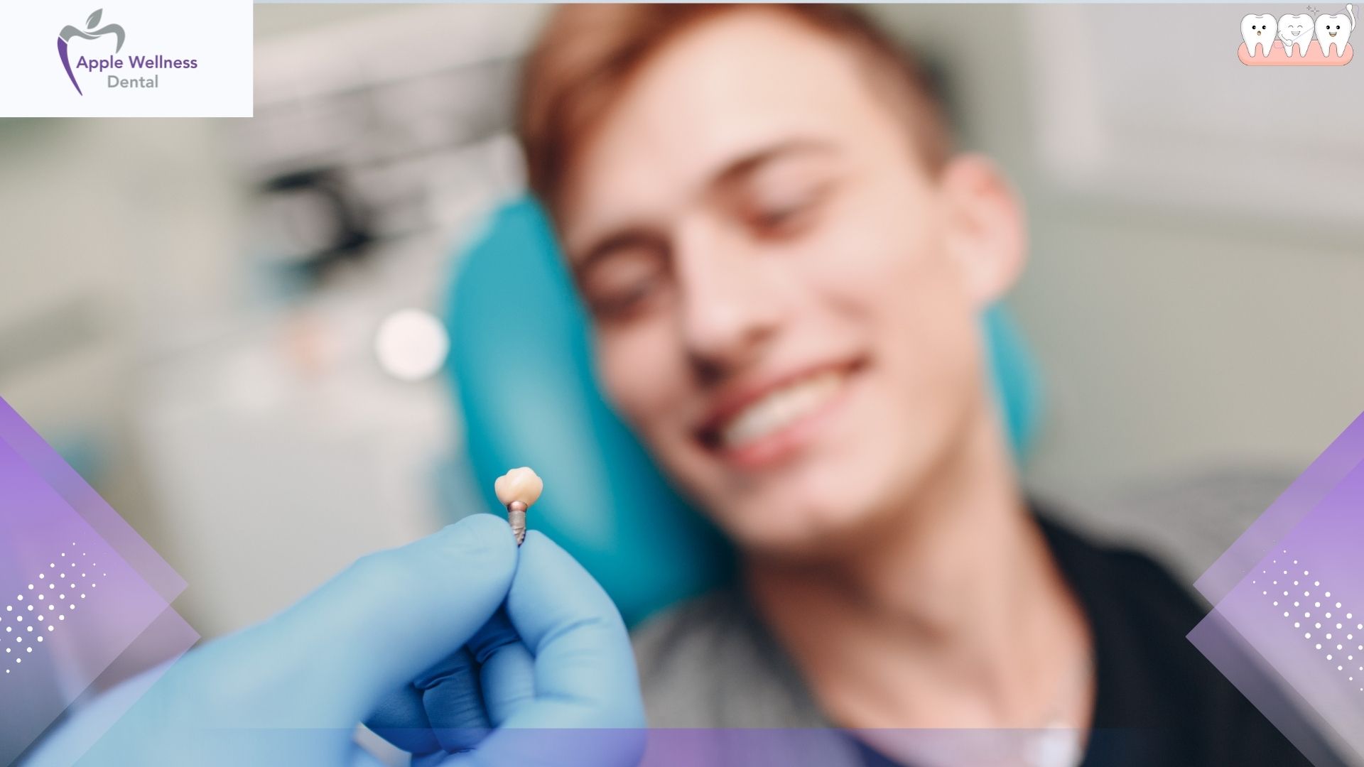From Consultation to Smile: The Full Process of Getting Dental Implants - Apple Wellness Dental