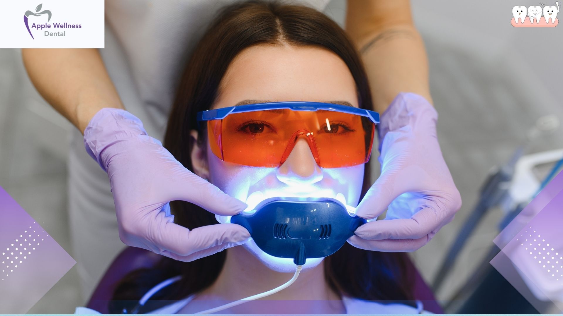 What Are the Risks of Teeth Whitening in Airdrie? Safety Guide - Apple Wellness Dental